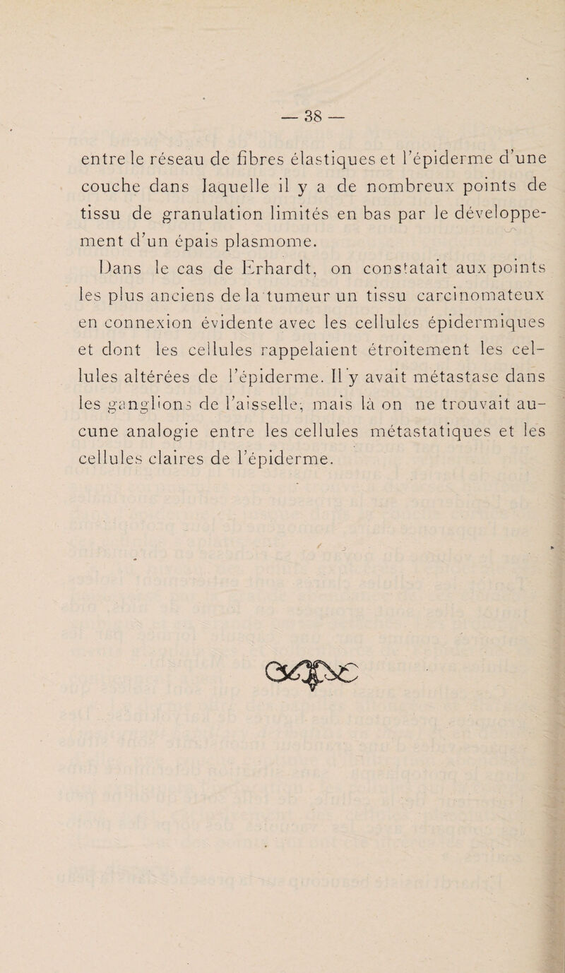 entre le réseau de fibres élastiques et l’épiderme d’une couche dans laquelle il y a de nombreux points de tissu de granulation limités en bas par le développe¬ ment d’un épais plasmome. Dans le cas de Erhardt, on constatait aux points les plus anciens delà tumeur un tissu carcinomateux en connexion évidente avec les cellules épidermiques et dont les cellules rappelaient étroitement les cel¬ lules altérées de l’épiderme. Il y avait métastase dans les ganglions de l’aisselle, mais là on ne trouvait au¬ cune analogie entre les cellules métastatiques et les cellules claires de l’épiderme. / j