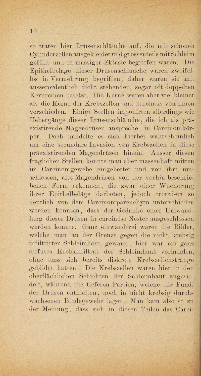 so traten hier Drüsenschläuche auf, die mit schönen Cy linderzellen ansgekleidet und grossen teils mit Schleim gefüllt und in mässiger Ektasie begriffen waren. Die Epithelbeläge dieser Drüsenschläuche waren zweifel¬ los in Vermehrung begriffen, daher waren sie mit ausserordentlich dicht stehenden, sogar oft doppelten Kernreihen besetzt. Die Kerne waren aber viel kleiner als die Kerne der Krebszellen und durchaus von ihnen verschieden. Einige Stellen imponirten allerdings wie Uebergänge dieser Drüsenschlänche, die ich als prä- existirende Magendrüsen anspreche, in Carcinomkör- per. Doch handelte es sich hierbei wahrscheinlich um eine secundäre Invasion von Krebszellen in diese präexistirenden Magendrüsen hinein. Ausser diesen fraglichen Stellen konnte man aber massenhaft mitten im Carcinomgewebe eingebettet und von ihm um¬ schlossen, alte Magendrüsen von der vorhin beschrie¬ benen Form erkennen, die zwar einer Wucherung ihrer Epithelbeläge darboten, jedoch trotzdem so deutlich von dem Carcinomparenchym unterschieden werden konnten, dass der Gedanke einer Umwand¬ lung dieser Drüsen in carcinöse .Nester ausgeschlossen werden konnte. Ganz einwandfrei waren die Bilder, welche man an der Grenze gegen die nicht krebsig infiltrirter Schleimhaut gewann; hier war ein ganz diffuses Krebsinfiltrat der Schleimhaut vorhanden, ohne dass sich bereits diskrete Krebszellenstränge gebildet hatten. Die Krebszellen waren hier in den oberflächlichen Schichten der Schleimhaut angesie¬ delt, während die tieferen Partien, welche die Eundi der Drüsen enthielten . noch in nicht krebsin durch- / O wachsenen Bindegewebe lagen. Man kam also so zu der Meinung, dass sich in diesen Teilen das Carci-