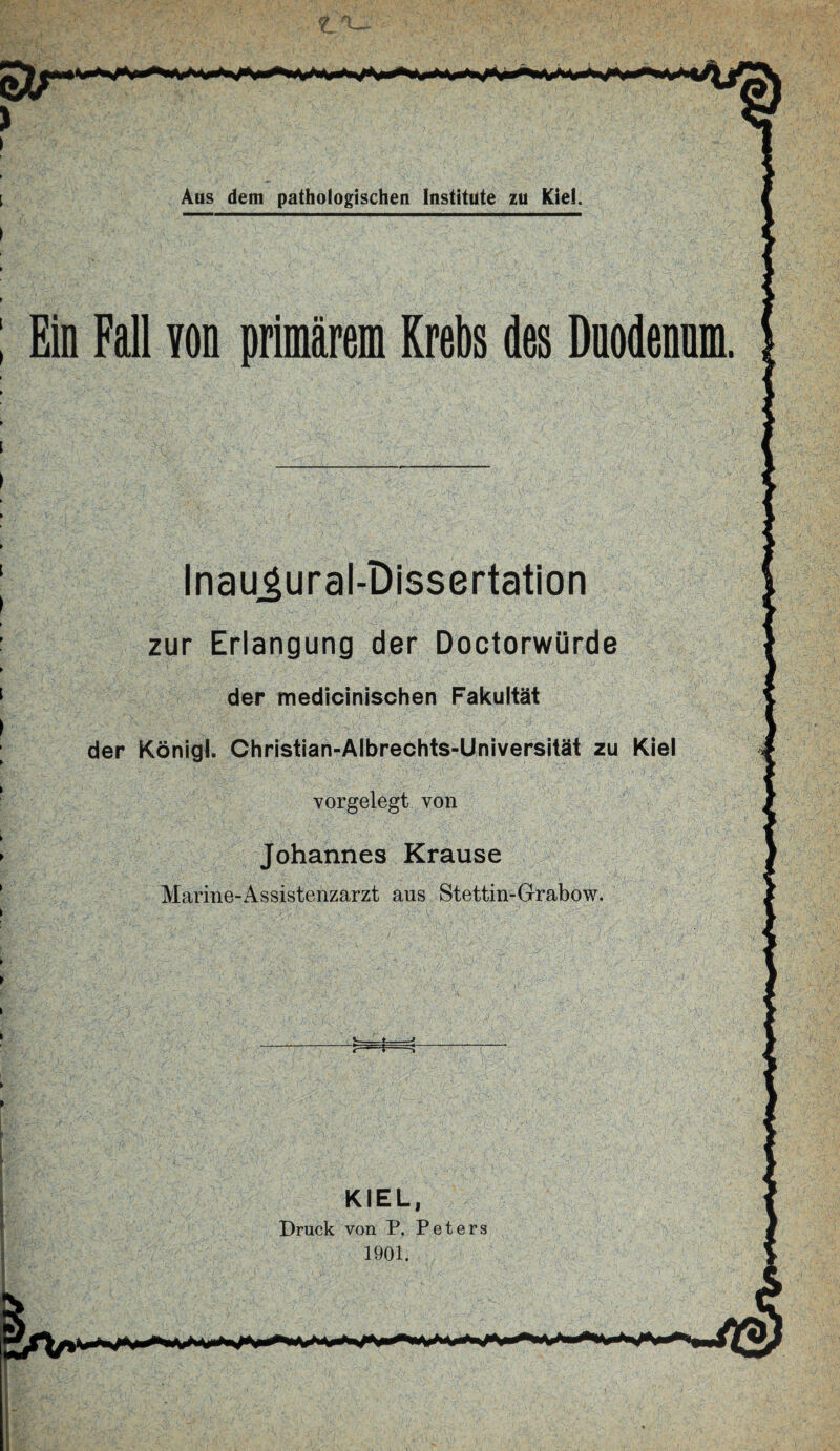 Ein Fall von primärem Krebs des Dnodennm. Inaogural-Dissertation zur Erlangung der Doctorwürde der medicinischen Fakultät der König!. Christian-Albrechts-Universität zu Kiel vorgelegt von Johannes Krause Marine-Assistenzarzt aus Stettin-Grabow. KIEL, Druck von P, Peters 1901.