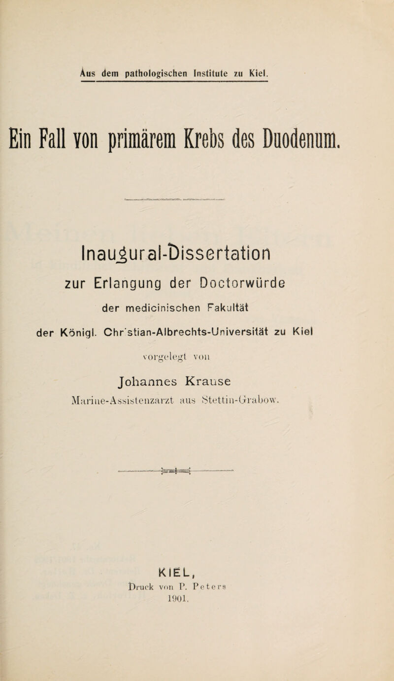 Ein Fall Yon primärem Krebs des Duodenum. InauJural-tHssertation zur Erlangung der Doctorwürde der medicinischen Fakultät der Königl. Chr'stian-Albrechts-Universität zu Kiel vorgelegt von Johannes Krause Marine-Assistenzarzt aus Stettin-Grabow. KIEL, l)ruck von P. Peters 1901.