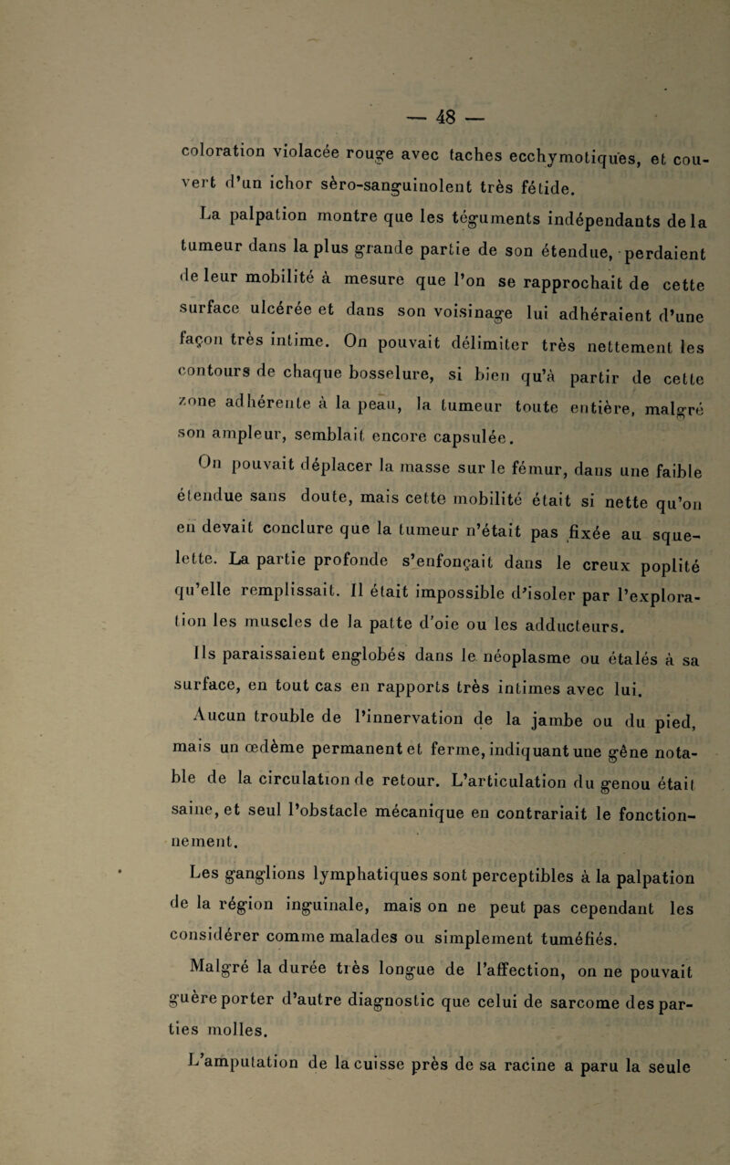 coloration violacée rouge avec taches ecchymotiques, et cou¬ vert d’un ichor sèro-sanguinolent très fétide. La palpation montre que les téguments indépendants delà tumeur dans la plus grande partie de son étendue, perdaient de leur mobilité à mesure que l’on se rapprochait de cette surface ulcérée et dans son voisinage lui adhéraient d’une façon très intime. On pouvait délimiter très nettement les contours de chaque bosselure, si bien qu’à partir de cette zone adhérente à la peau, la tumeur toute entière, malgré son ampleur, semblait encore capsulée. On pouvait déplacer la masse sur le fémur, dans une faible étendue sans doute, mais cette mobilité était si nette qu’on en devait conclure que la tumeur n’était pas fixée au sque¬ lette. La partie profonde s’enfonçait dans le creux poplité qu elle remplissait. Il était impossible d’isoler par l’explora¬ tion les muscles de la patte d oie ou les adducteurs. Ils paraissaient englobés dans le néoplasme ou étalés à sa surface, en tout cas en rapports très intimes avec lui. Aucun trouble de l’innervation de la jambe ou du pied, mais un œdème permanent et ferme, indiquant une gêne nota¬ ble de la circulation de retour. L’articulation du genou était saine, et seul l’obstacle mécanique en contrariait le fonction¬ nement. Les ganglions lymphatiques sont perceptibles à la palpation de la région inguinale, mais on ne peut pas cependant les considérer comme malades ou simplement tuméfiés. Malgré la durée très longue de l’affection, on ne pouvait guère porter d’autre diagnostic que celui de sarcome des par¬ ties molles. L’amputation de la cuisse près de sa racine a paru la seule