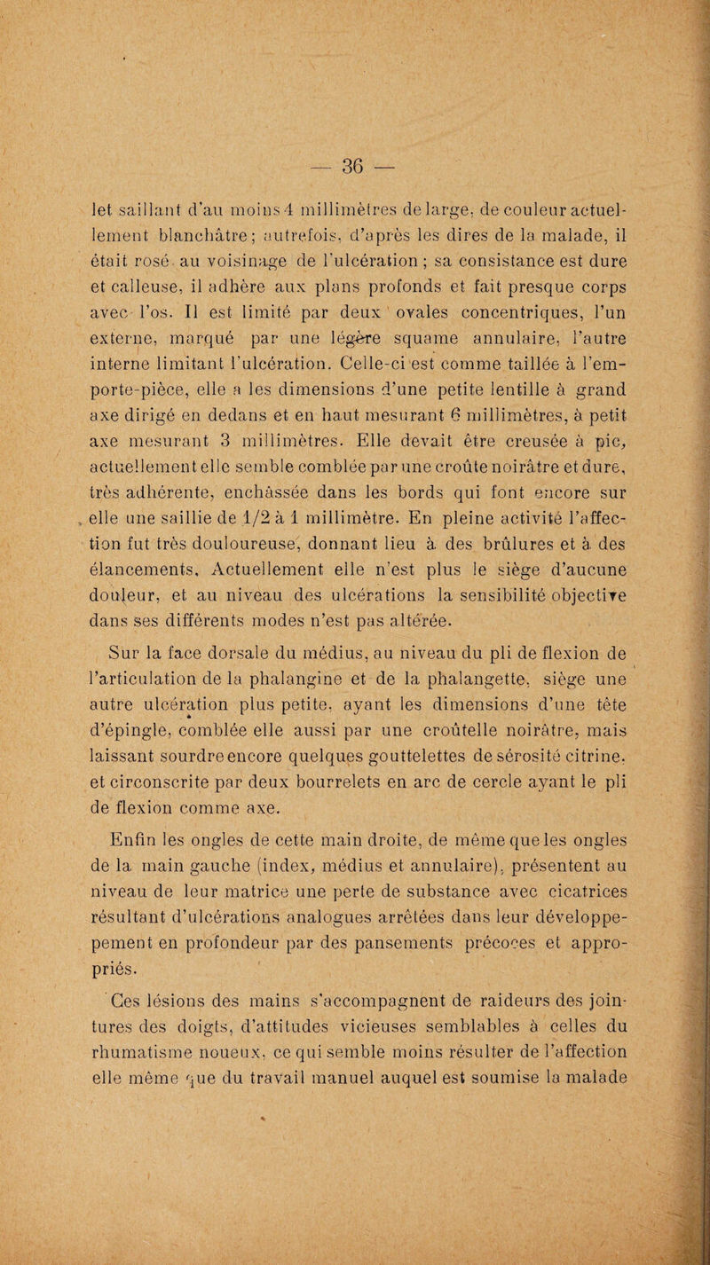 let saillant d’au moinsd millimètres de large, de couleur actuel¬ lement blanchâtre; autrefois, d’après les dires de la malade, il était rosé au voisinage de l’ulcération ; sa consistance est dure et calleuse, il adhère aux plans profonds et fait presque corps avec l’os. Il est limité par deux ovales concentriques, l’un externe, marqué par une légère squame annulaire, l’autre interne limitant l’ulcération. Celle-ci est comme taillée à l’em¬ porte-pièce, elle a les dimensions d’une petite lentille à grand axe dirigé en dedans et en haut mesurant 6 millimètres, à petit axe mesurant 3 millimètres. Elle devait être creusée à pic,, actuellement elle semble comblée par une croûte noirâtre et dure, très adhérente, enchâssée dans les bords qui font encore sur elle une saillie de 1/2 à 1 millimètre. En pleine activité l’affec¬ tion fut très douloureuse, donnant lieu à des brûlures et à des élancements. Actuellement elle n’est plus le siège d’aucune douleur, et au niveau des ulcérations la sensibilité objective dans ses différents modes n’est pas altérée. Sur la face dorsale du médius, au niveau du pli de flexion de l’articulation de la phalangine et de la phalangette, siège une autre ulcération plus petite, ayant les dimensions d’une tête d’épingle, comblée elle aussi par une croûtelle noirâtre, mais laissant sourdreencore quelques gouttelettes de sérosité citrine, et circonscrite per deux bourrelets en arc de cercle ayant le pli de flexion comme axe. Enfin les ongles de cette main droite, de même que les ongles de la main gauche (index, médius et annulaire), présentent au niveau de leur matrice une perte de substance avec cicatrices résultant d’ulcérations analogues arrêtées dans leur développe- pement en profondeur par des pansements précoces et appro¬ priés. Ces lésions des mains s’accompagnent de raideurs des join¬ tures des doigts, d’attitudes vicieuses semblables à celles du rhumatisme noueux, ce qui semble moins résulter de l’affection elle même que du travail manuel auquel est soumise la malade