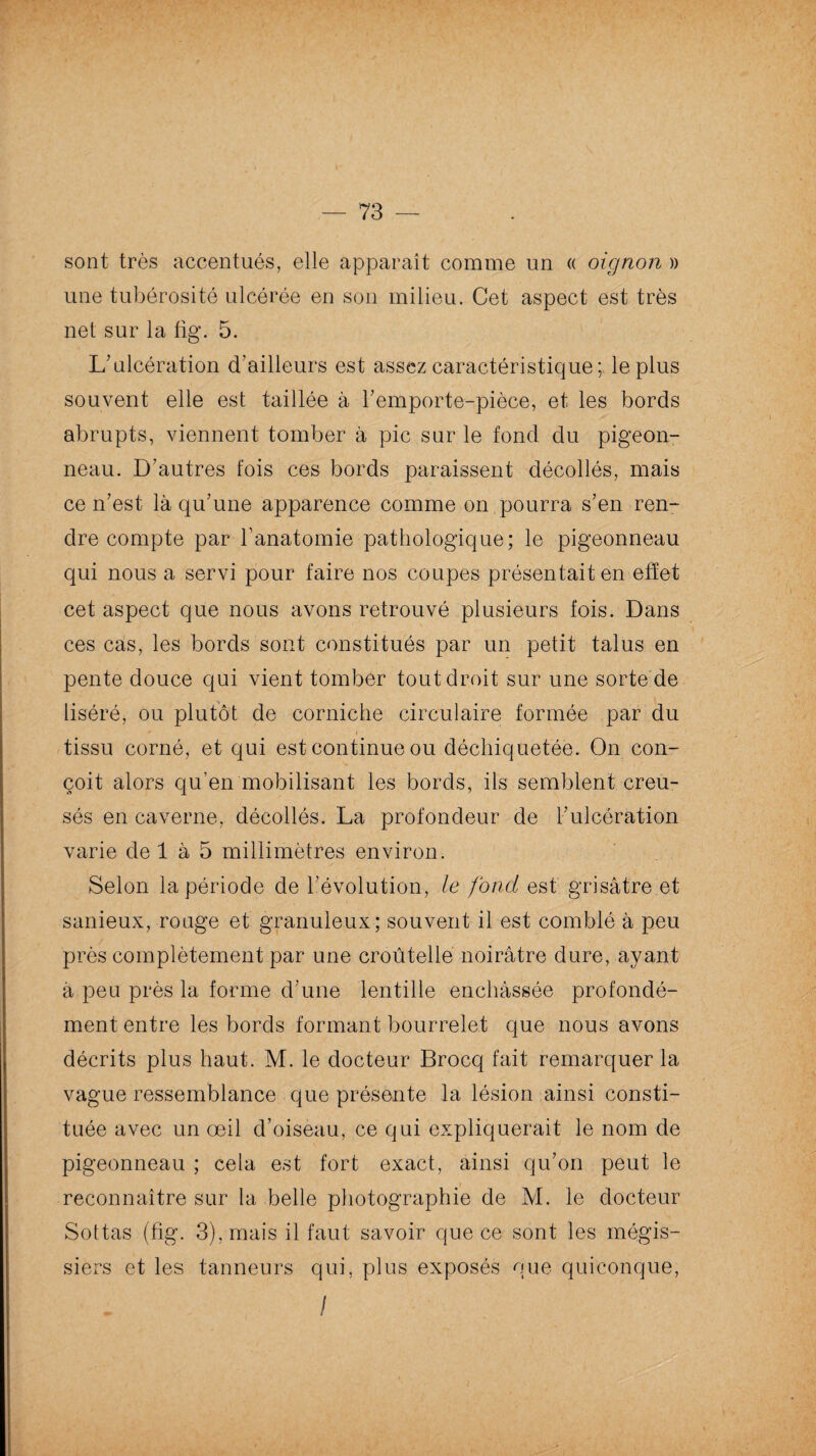 sont très accentués, elle apparaît comme un « oignon » une tubérosité ulcérée en son milieu. Cet aspect est très net sur la fig. 5. L'ulcération d’ailleurs est assez caractéristique; le plus souvent elle est taillée à l'emporte-pièce, et les bords abrupts, viennent tomber à pic sur le fond du pigeon¬ neau. D'autres fois ces bords paraissent décollés, mais ce n'est là qu'une apparence comme on pourra s'en ren¬ dre compte par l’anatomie pathologique; le pigeonneau qui nous a servi pour faire nos coupes présentait en effet cet aspect que nous avons retrouvé plusieurs fois. Dans ces cas, les bords sont constitués par un petit talus en pente douce qui vient tomber tout droit sur une sorte de liséré, ou plutôt de corniche circulaire formée par du tissu corné, et qui est continue ou déchiquetée. On con¬ çoit alors qu’en mobilisant les bords, ils semblent creu¬ sés en caverne, décollés. La profondeur de l'ulcération varie de 1 à 5 millimètres environ. Selon la période de l’évolution, le fond est grisâtre et sanieux, rouge et granuleux; souvent il est comblé à peu près complètement par une croûtelle noirâtre dure, ayant à peu près la forme d'une lentille enchâssée profondé¬ ment entre les bords formant bourrelet que nous avons décrits plus haut. M. le docteur Brocq fait remarquer la vague ressemblance que présente la lésion ainsi consti¬ tuée avec un œil d’oiseau, ce qui expliquerait le nom de pigeonneau ; cela est fort exact, ainsi qu'on peut le reconnaître sur la belle photographie de M. le docteur Sottas (fig. 3), mais il faut savoir que ce sont les mégis- siers et les tanneurs qui, plus exposés que quiconque, /