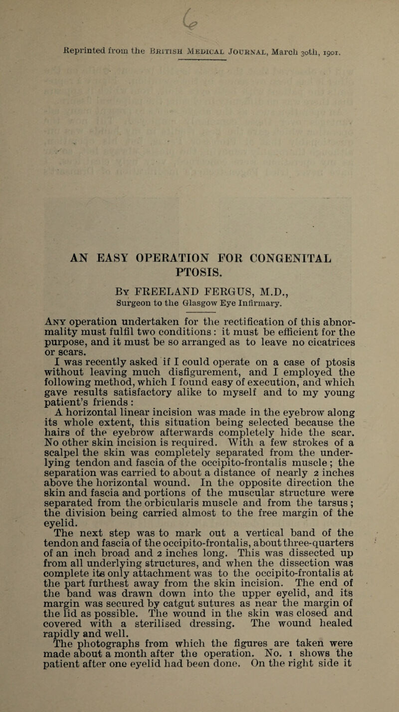 / Q7 Keprinted from the British Medical Journal, March 30th, 1901. AN EASY OPERATION FOR CONGENITAL PTOSIS. By FREELAND FERGUS, M.D., Surgeon to the Glasgow Eye Infirmary. Any operation undertaken for the rectification of this abnor¬ mality must fulfil two conditions : it must be efficient for the purpose, and it must be so arranged as to leave no cicatrices or scars. I was recently asked if I could operate on a case of ptosis without leaving much disfigurement, and I employed the following method, which I found easy of execution, and which gave results satisfactory alike to myself and to my young patient’s friends : A horizontal linear incision was made in the eyebrow along its whole extent, this situation being selected because the hairs of the eyebrow afterwards completely hide the scar. No other skin incision is required. With a few strokes of a scalpel the skin was completely separated from the under¬ lying tendon and fascia of the occipito-frontalis muscle ; the separation was carried to about a distance of nearly 2 inches above the horizontal wound. In the opposite direction the skin and fascia and portions of the muscular structure were separated from the orbicularis muscle and from the tarsus ; the division being carried almost to the free margin of the eyelid. The next step was to mark out a vertical band of the tendon and fascia of the occipito-frontalis, about three-quarters of an inch broad and 2 inches long. This was dissected up from all underlying structures, and when the dissection was complete ite only attachment was to the occipito-frontalis at the part furthest away from the skin incision. The end of the band was drawn down into the upper eyelid, and its margin was secured by catgut sutures as near the margin of the lid as possible. The wound in the skin was closed and covered with a sterilised dressing. The wound healed rapidly and well. The photographs from which the figures are taken were made about a month after the operation. No. 1 shows the patient after one eyelid had been done. On the right side it