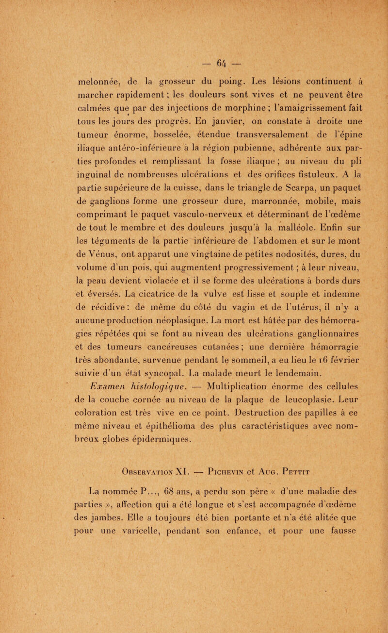 melonnée, de la grosseur du poing. Les lésions continuent à marcher rapidement ; les douleurs sont vives et ne peuvent être calmées que par des injections de morphine; l'amaigrissement fait tous les jours des progrès. En janvier, on constate à droite une tumeur énorme, bosselée, étendue transversalement de l'épine iliaque antéro-inférieure à la région pubienne, adhérente aux par¬ ties profondes et remplissant la fosse iliaque ; au niveau du pli inguinal de nombreuses ulcérations et des orifices fistuleux. A la partie supérieure de la cuisse, dans le triangle de Scarpa, un paquet de ganglions forme une grosseur dure, marronnée, mobile, mais comprimant le paquet vasculo-nerveux et déterminant de l'oedème de tout le membre et des douleurs jusqu'à la malléole. Enfin sur les téguments de la partie inférieure de l'abdomen et sur le mont de Vénus, ont apparut une vingtaine de petites nodosités, dures, du volume d'un pois, qui augmentent progressivement ; à leur niveau, la peau devient violacée et il se forme des ulcérations à bords durs et éversés. La cicatrice de la vulve est lisse et souple et indemne de récidive : de même du côté du vagin et de l’utérus, il ny a aucune production néoplasique. La mort est hâtée par des hémorra¬ gies répétées qui se font au niveau des ulcérations ganglionnaires et des tumeurs cancéreuses cutanées; une dernière hémorragie très abondante, survenue pendant le sommeil, a eu lieu le 16 février suivie d’un état syncopal. La malade meurt le lendemain. Examen histologique. — Multiplication énorme des cellules de la couche cornée au niveau de la plaque de leucoplasie. Leur coloration est très vive en ce point. Destruction des papilles à ce même niveau et épithélioma des plus caractéristiques avec nom¬ breux globes épidermiques. Observation XL — Pichevin et Aug. Pettit La nommée P..., 68 ans, a perdu son père « d'une maladie des parties », affection qui a été longue et s'est accompagnée d'œdème des jambes. Elle a toujours été bien portante et n'a été alitée que pour une varicelle, pendant son enfance, et pour une fausse