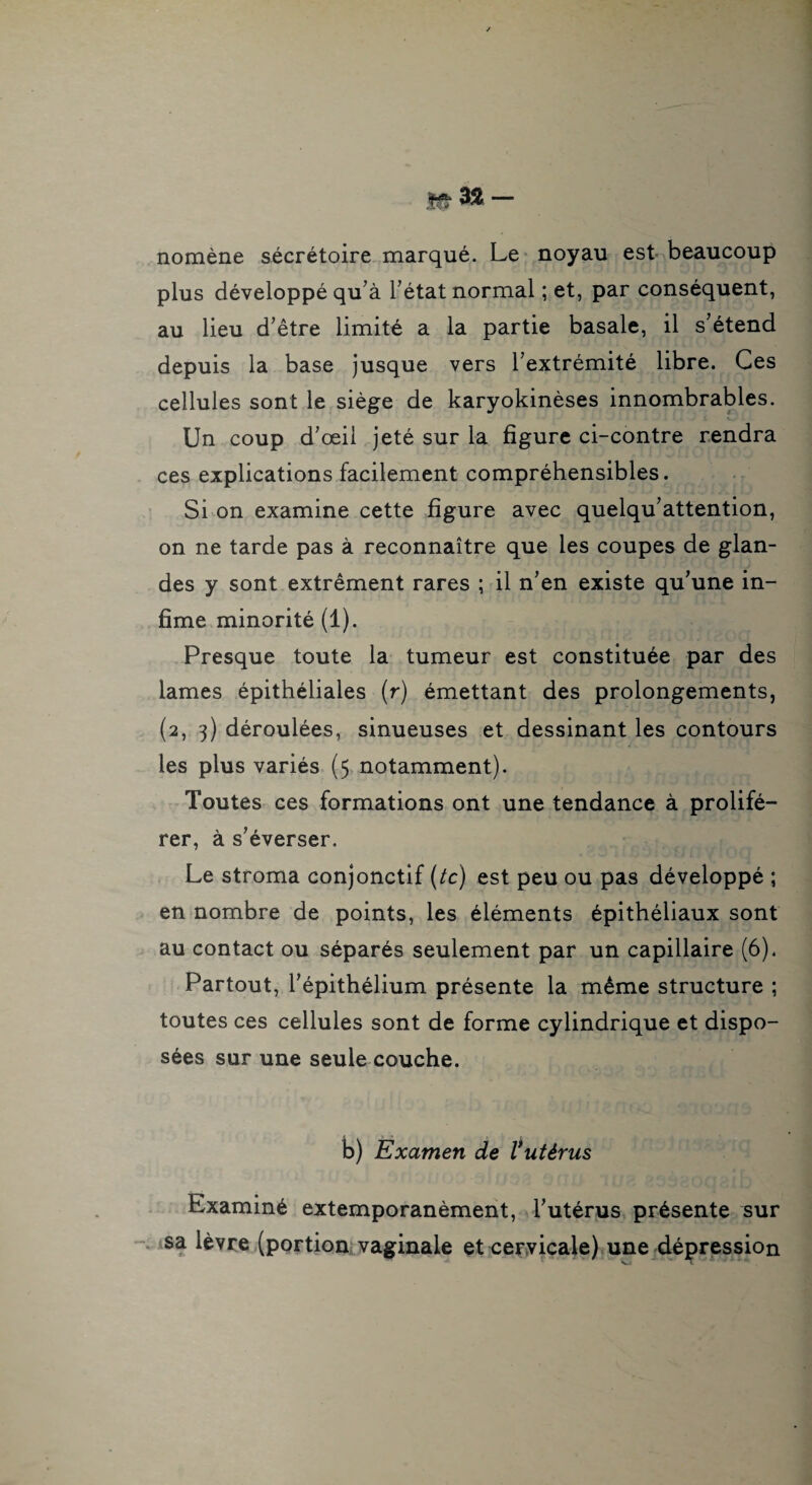 nomène sécrétoire marqué. Le noyau est beaucoup plus développé qu’à l’état normal ; et, par conséquent, au lieu d’être limité a la partie basale, il s’étend depuis la base jusque vers l’extrémité libre. Ces cellules sont le siège de karyokinèses innombrables. Un coup d’œil jeté sur la figure ci-contre rendra ces explications facilement compréhensibles. Si on examine cette figure avec quelqu’attention, on ne tarde pas à reconnaître que les coupes de glan¬ des y sont extrêment rares ; il n’en existe qu’une in¬ fime minorité (1). Presque toute la tumeur est constituée par des lames épithéliales (r) émettant des prolongements, (2, 3) déroulées, sinueuses et dessinant les contours les plus variés (5 notamment). Toutes ces formations ont une tendance à prolifé¬ rer, à s’éverser. Le stroma conjonctif (te) est peu ou pas développé ; en nombre de points, les éléments épithéliaux sont au contact ou séparés seulement par un capillaire (6). Partout, l’épithélium présente la même structure ; toutes ces cellules sont de forme cylindrique et dispo¬ sées sur une seule couche. b) Examen de Vutérus Examiné extemporanèmeiit, l’utérus présente sur - sa lèvre (pgrtiont vaginale et cervicale) une dépression