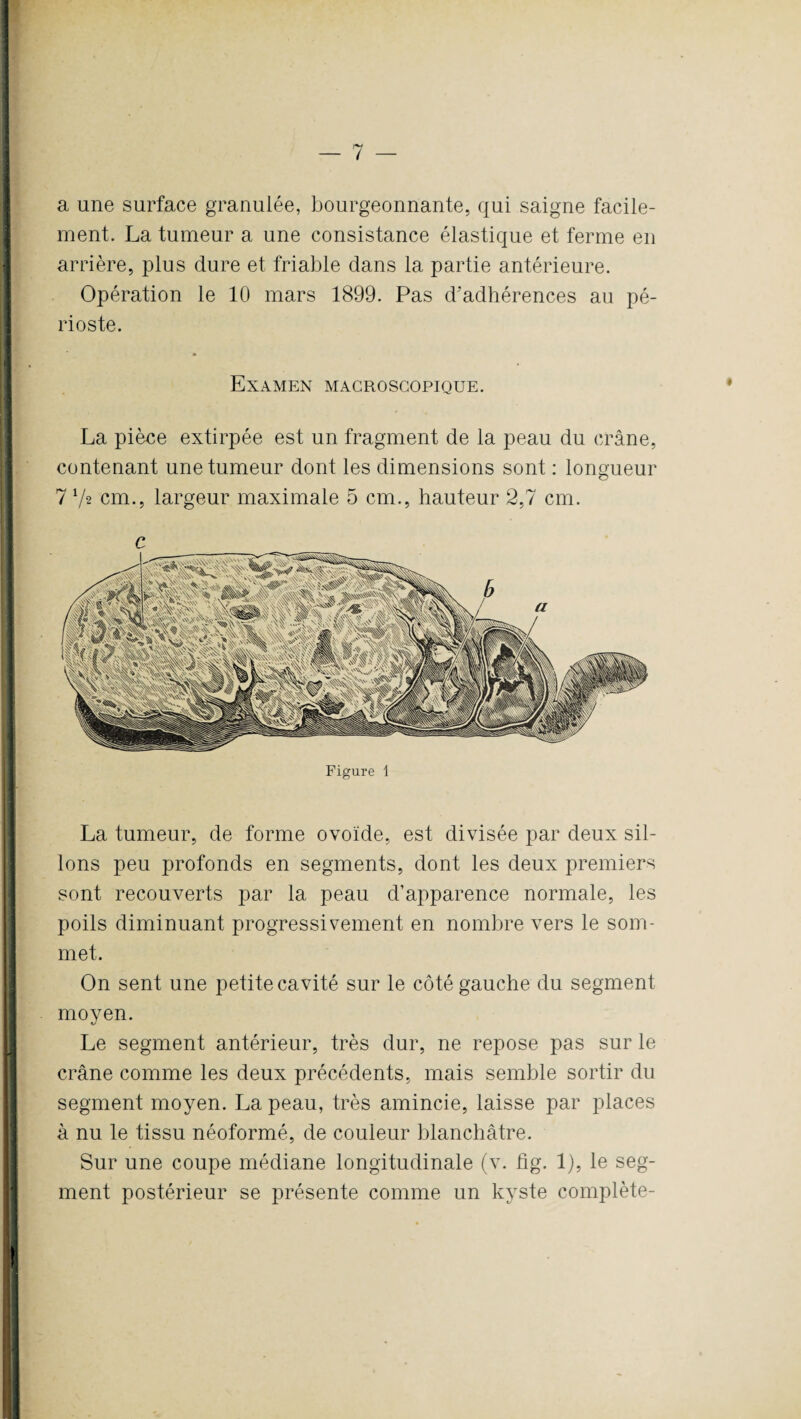 a une surface granulée, bourgeonnante, qui saigne facile¬ ment. La tumeur a une consistance élastique et ferme en arrière, plus dure et friable dans la partie antérieure. Opération le 10 mars 1899. Pas d’adhérences au pé¬ rioste. Examen macroscopique. La pièce extirpée est un fragment de la peau du crâne, contenant une tumeur dont les dimensions sont : longueur 7 V* cm., largeur maximale 5 cm., hauteur 2,7 cm. c Figure 1 La tumeur, de forme ovoïde, est divisée par deux sil¬ lons peu profonds en segments, dont les deux premiers sont recouverts par la peau d’apparence normale, les poils diminuant progressivement en nombre vers le som¬ met. On sent une petite cavité sur le côté gauche du segment moyen. Le segment antérieur, très dur, ne repose pas sur le crâne comme les deux précédents, mais semble sortir du segment moyen. La peau, très amincie, laisse par places à nu le tissu néoformé, de couleur blanchâtre. Sur une coupe médiane longitudinale (v. fig. 1), le seg¬ ment postérieur se présente comme un kyste complète-