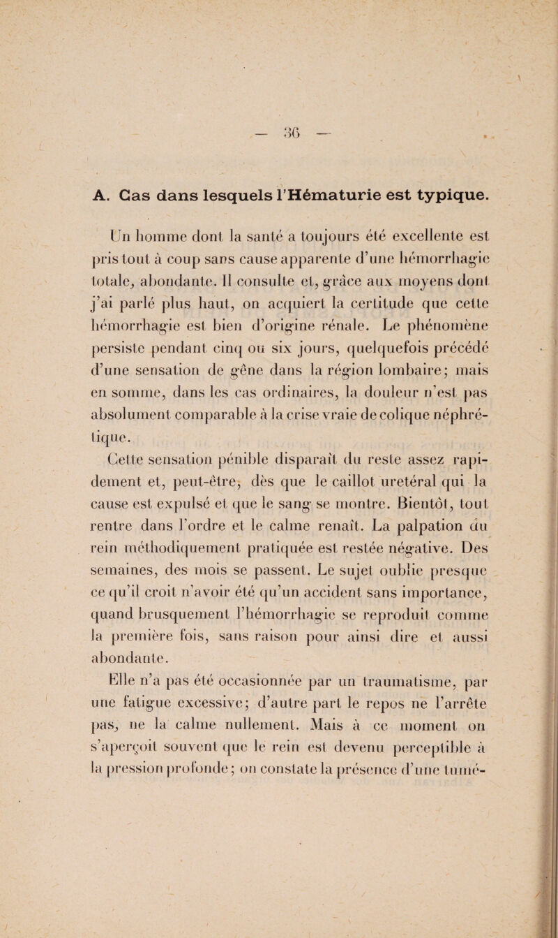 A. Cas dans lesquels l’Hématurie est typique. Un homme dont la santé a toujours été excellente est pris tout à coup sans cause apparente d’une hémorrhagie totale,, abondante. Il consulte et, grâce aux moyens dont j’ai parlé plus haut, on acquiert la certitude que cette hémorrhagie est bien d’origine rénale. Le phénomène persiste pendant cinq ou six jours, quelquefois précédé d’une sensation de gêne dans la région lombaire; mais en somme, dans les cas ordinaires, la douleur n’est pas absolument comparable à la crise vraie de colique néphré¬ tique. Cette sensation pénible disparait du reste assez rapi¬ dement et, peut-être, dès que le caillot urétéral qui la cause est expulsé et que le sang se montre. Bientôt, tout rentre dans l’ordre et le calme renaît. La palpation du rein méthodiquement pratiquée est restée négative. Des semaines, des mois se passent. Le sujet oublie presque ce qu’il croit n’avoir été qu’un accident sans importance, quand brusquement l’hémorrhagie se reproduit comme la première fois, sans raison pour ainsi dire et aussi abondante. Klle n’a pas été occasionnée par un traumatisme, par une fatigue excessive; d’autre part le repos ne l’arrête pas, ne la calme nullement. Mais à ce moment on s’aperçoit souvent que le rein est devenu perceptible à la pression profonde ; on constate la présence d’une tu nié-