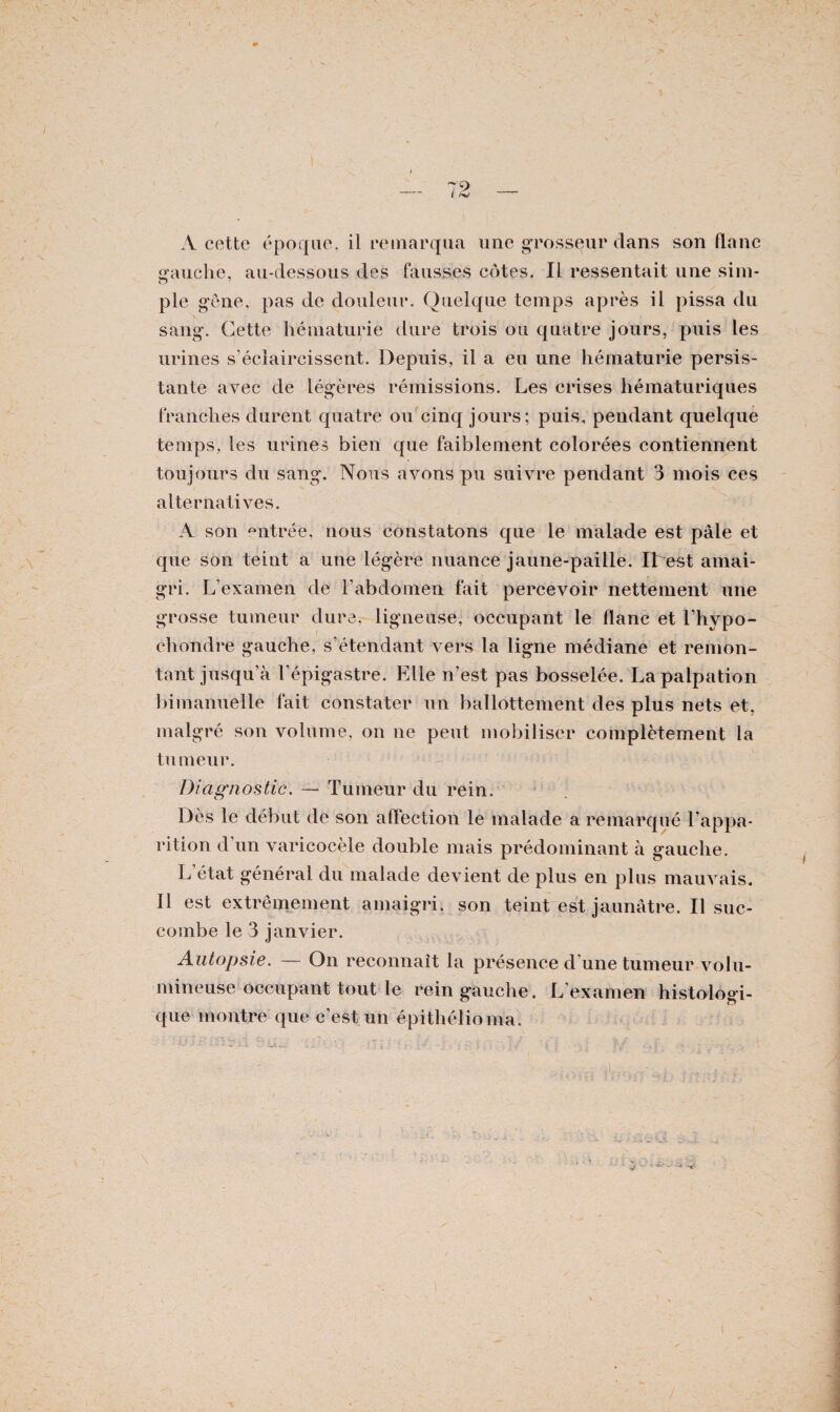 sfauche, au-dessous des fausses côtes. IL ressentait une sim- pie gêne, pas de douleur. Quelque temps après il pissa du sang. Cette hématurie dure trois ou quatre jours, puis les urines s’éclaircissent. Depuis, il a eu une hématurie persis¬ tante avec de légères rémissions. Les crises hématuriques franches durent quatre ou cinq jours; puis, pendant quelque temps, les urines bien que faiblement colorées contiennent toujours du sang. Nous avons pu suivre pendant 3 mois ces alternatives. A son entrée, nous constatons que le malade est pâle et que son teint a une légère nuance jaune-paille. ILest amai¬ gri. L’examen de l’abdomen fait percevoir nettement une grosse tumeur dure, ligneuse, occupant le flanc et l’hypo- chondre gauche, s’étendant vers la ligne médiane et remon¬ tant jusqu’à l’épigastre. Elle n’est pas bosselée. La palpation bimanuelle fait constater un ballottement des plus nets et, malgré son volume, on ne peut mobiliser complètement la tumeur. Diagnostic. — Tumeur du rein. Dès le début de son affection le malade a remarqué l’appa¬ rition d’un varicocèle double mais prédominant à gauche. L’état général du malade devient de plus en plus mauvais. Il est extrêmement amaigri, son teint est jaunâtre. Il suc¬ combe le 3 janvier. Autopsie. — On reconnaît la présence d’une tumeur volu¬ mineuse occupant tout le rein gauche. L’examen histologi¬ que montre que c’est un épithélioma.