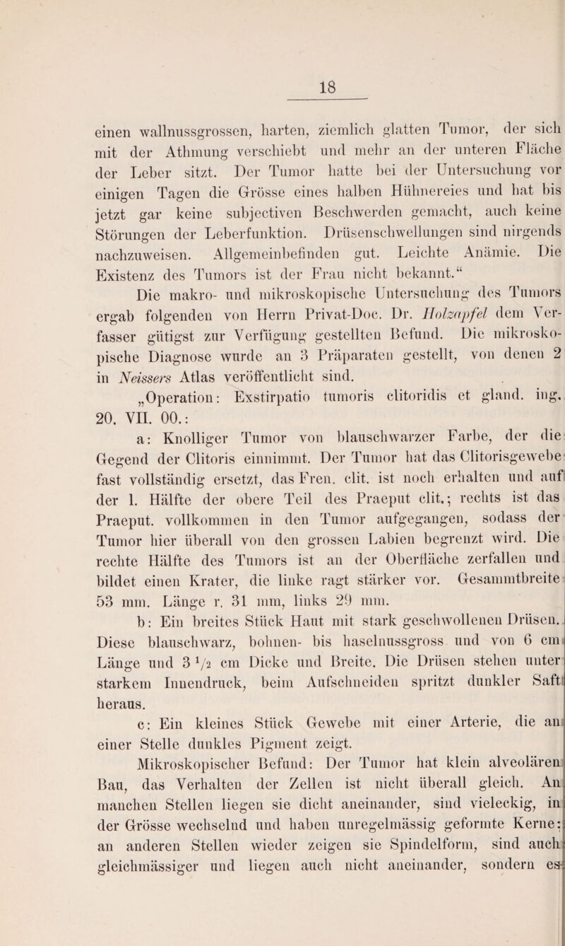 einen wallnussgrossen, harten, ziemlich glatten Tumor, der sich mit der Athmung verschiebt und mehr an der unteren Fläche der Leber sitzt. Der Tumor hatte hei der Untersuchung vor einigen Tagen die Grösse eines halben Hühnereies und hat bis jetzt gar keine subjectiven Beschwerden gemacht, aucli keine Störungen der Leberfunktion. Drüsenschwellungen sind nirgends nachzuweisen. Allgemeinbefinden gut. Leichte Anämie. Die Existenz des Tumors ist der Frau nicht bekannt.“ Die makro- und mikroskopische Untersuchung des Tumors ergab folgenden von Herrn Privat-Doc. Dr. Holzapfel dem Ver¬ fasser gütigst zur Verfügung gestellten Befund. Die mikrosko¬ pische Diagnose wurde an 3 Präparaten gestellt, von denen 2 in Neissers Atlas veröffentlicht sind. „Operation: Exstirpatio tumoris clitoridis et gland. ing. 20. VII. 00.: a: Knolliger Tumor von blauschwarzer Farbe, der die Gegend der Clitoris einnimmt. Der Tumor hat das Clitorisgewebe fast vollständig ersetzt, das Freu. clit. ist noch erhalten und auf der 1. Hälfte der obere Teil des Praeput clit.; rechts ist das Praeput. vollkommen in den Tumor aufgegangen, sodass der Tumor hier überall von den grossen Labien begrenzt wird. Die rechte Hälfte des Tumors ist an der Oberfläche zerfallen und bildet einen Krater, die linke ragt stärker vor. Gesammtbreite 53 mm. Länge r. 31 mm, links 29 mm. b: Ein breites Stück Haut mit stark geschwollenen Drüsen. Diese blauschwarz, höhnen- bis haselnussgross und von 6 cm Länge und 3 l/z cm Dicke und Breite. Die Drüsen stehen unter starkem Innendruck, beim Aufschneiden spritzt dunkler Saft heraus. c: Ein kleines Stück Gewebe mit einer Arterie, die an einer Stelle dunkles Pigment zeigt. Mikroskopischer Befund: Der Tumor hat klein alveolären Bau, das Verhalten der Zellen ist nicht überall gleich. An manchen Stellen liegen sie dicht aneinander, sind vieleckig, in der Grösse wechselnd und haben unregelmässig geformte Kerne: an anderen Stellen wieder zeigen sie Spindelform, sind auch gleiclunässiger und liegen auch nicht aneinander, sondern es