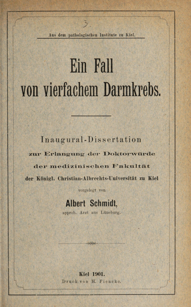 ... ■/ A-r ■ 4 ) ‘v Ein Fall von vierfachem Darmkrebs. i i Inaugur al-Dissertation zur Erlangung der Doktor würde der medizinischen Fakultät der Königl. Christian-Albreehts-IJniYersität zu Kiel vorgelegt von Albert Schmidt, approb. Arzt aus Lüneburg. ' • * | Kiel 1901. Druck von H. Fiencke.