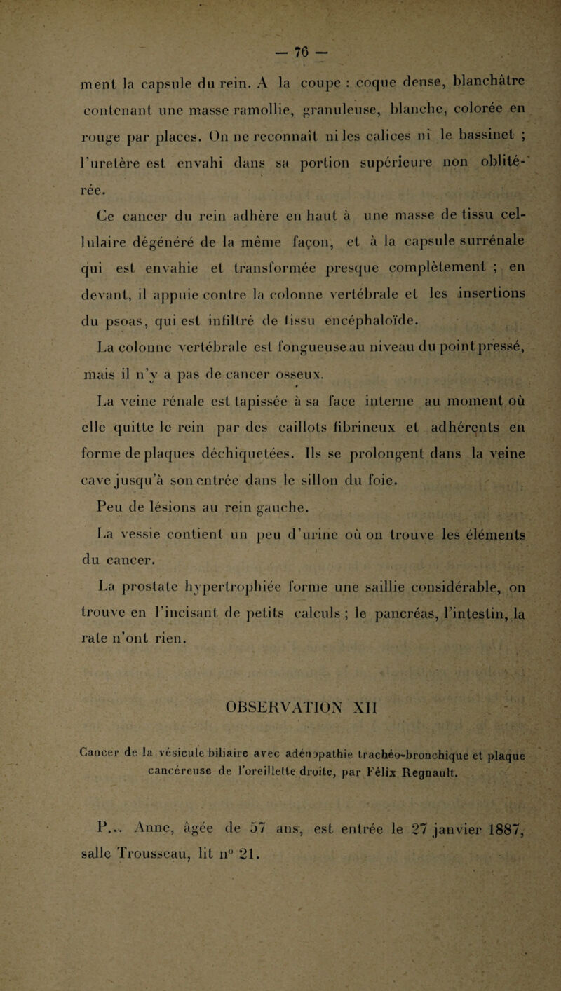 ment la capsule du rein. A la coupe : coque dense, blanchâtre contenant une masse ramollie, granuleuse, blanche, colorée en rouge par places. On ne reconnaît ni les calices ni le bassinet ; l’uretère est envahi dans sa portion supérieure non oblité¬ rée. Ce cancer du rein adhère en haut à une masse de tissu cel¬ lulaire dégénéré de la même façon, et à la capsule surrénale qui est envahie et transformée presque complètement ; en devant, il appuie contre la colonne vertébrale et les insertions du psoas, qui est infiltré de lissu encéphaloïde. La colonne vertébrale est fongueuse au niveau du point pressé, mais il n’y a pas de cancer osseux. La veine rénale est tapissée à sa face interne au moment où elle quitte le rein par des caillots fibrineux et adhérents en forme de plaques déchiquetées. Ils se prolongent dans la veine cave jusqu’à son entrée dans le sillon du foie. Peu de lésions au rein gauche. La vessie contient un peu d’urine où on trouve les éléments du cancer. La prostate hypertrophiée forme une saillie considérable, on trouve en l’incisant de petits calculs; le pancréas, l’intestin, la rate n’ont rien. OBSERVATION XII Cancer de la vésicule biliaire avec adénopathie trachéo-bronchique et plaque cancéreuse de l’oreillette droite, par Félix Régnault. P... Anne, âgée de 57 ans, est entrée le 27 janvier 1887, salle Trousseau, lit n° 21.