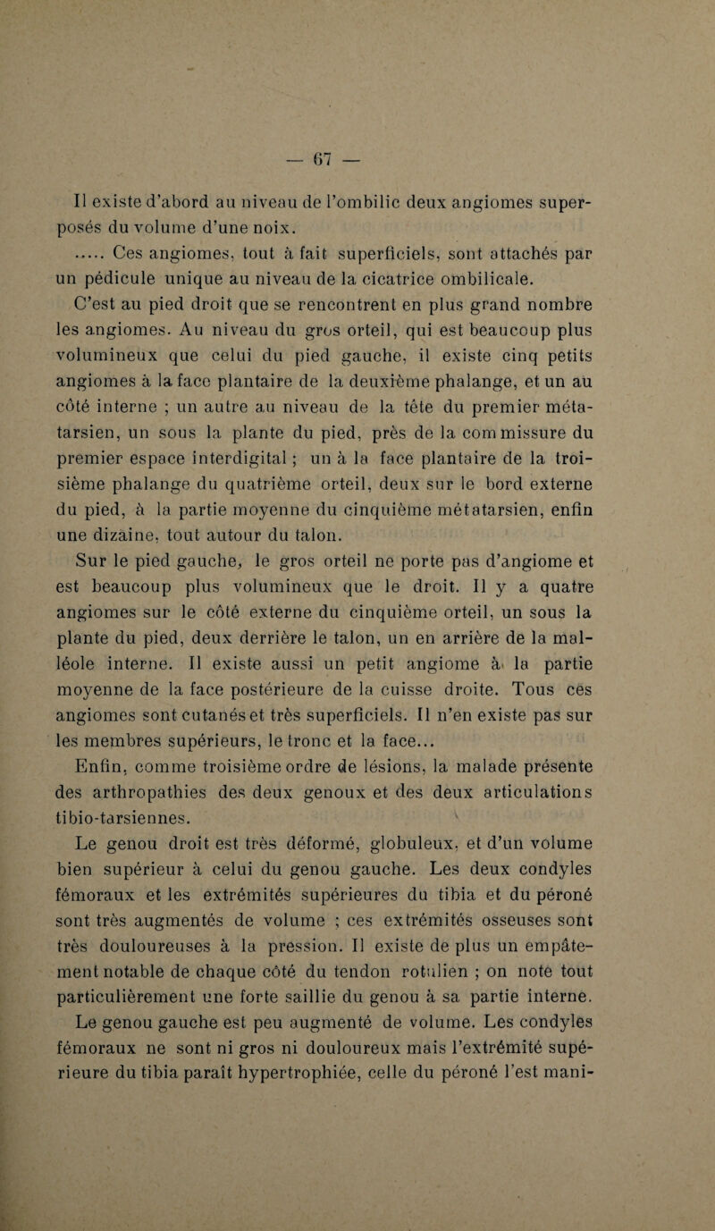 Il existe d’abord au niveau de l’ombilic deux angiomes super¬ posés du volume d’une noix. . Ces angiomes, tout à fait superficiels, sont attachés par un pédicule unique au niveau de la cicatrice ombilicale. C’est au pied droit que se rencontrent en plus grand nombre les angiomes. Au niveau du gros orteil, qui est beaucoup plus volumineux que celui du pied gauche, il existe cinq petits angiomes à la face plantaire de la deuxième phalange, et un au côté interne ; un autre au niveau de la tête du premier méta¬ tarsien, un sous la plante du pied, près de la commissure du premier espace interdigital ; un à la face plantaire de la troi¬ sième phalange du quatrième orteil, deux sur le bord externe du pied, à la partie moyenne du cinquième métatarsien, enfin une dizaine, tout autour du talon. Sur le pied gauche, le gros orteil ne porte pas d’angiome et est beaucoup plus volumineux que le droit. Il y a quatre angiomes sur le côté externe du cinquième orteil, un sous la plante du pied, deux derrière le talon, un en arrière de la mal¬ léole interne. Il existe aussi un petit angiome à' la partie moyenne de la face postérieure de la cuisse droite. Tous ces angiomes sont cutanés et très superficiels. Il n’en existe pas sur les membres supérieurs, le tronc et la face... Enfin, comme troisième ordre de lésions, la malade présente des arthropathies des deux genoux et des deux articulations tibio-tarsiennes. Le genou droit est très déformé, globuleux, et d’un volume bien supérieur à celui du genou gauche. Les deux condyles fémoraux et les extrémités supérieures du tibia et du péroné sont très augmentés de volume ; ces extrémités osseuses sont très douloureuses à la pression. Il existe de plus un empâte¬ ment notable de chaque côté du tendon rotulien ; on note tout particulièrement une forte saillie du genou à sa partie interne. Le genou gauche est peu augmenté de volume. Les condyles fémoraux ne sont ni gros ni douloureux mais l’extrémité supé¬ rieure du tibia paraît hypertrophiée, celle du péroné l’est mani-