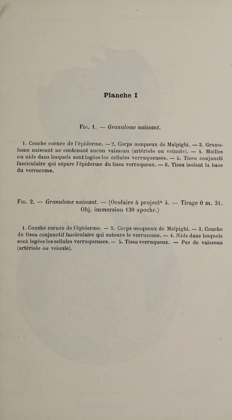 Fig. 1. — Granulome naissant. 1. Couche cornée de l’épiderme. — 2. Corps muqueux de Malpighi. — 3. Granu¬ lome naissant ne contenant aucun vaisseau (artériole ou veinule). — 4. Mailles ou nids dans lesquels sont logées les cellules verruqueuses. — 5. Tissu conjoncti fasciculaire qui sépare l’épiderme du tissu verruqueux. — 6. Tissu isolant la base du verrucome. Fig. 2. — Granulome naissant. — (Oculaire à projectn 4. — Tirage 0 m. 31. Obj. immersion 130 apochr.) 1. Couche cornée de l’épiderme. — 2. Corps muqueux de Malpighi. — 3. Couche de tissu conjonctif fasciculaire qui entoure le verrucome. — 4. Nids dans lesquels sont logées les cellules verruqueuses.— 5. Tissu verruqueux. — Pas de vaisseau (artériole ou veinule).