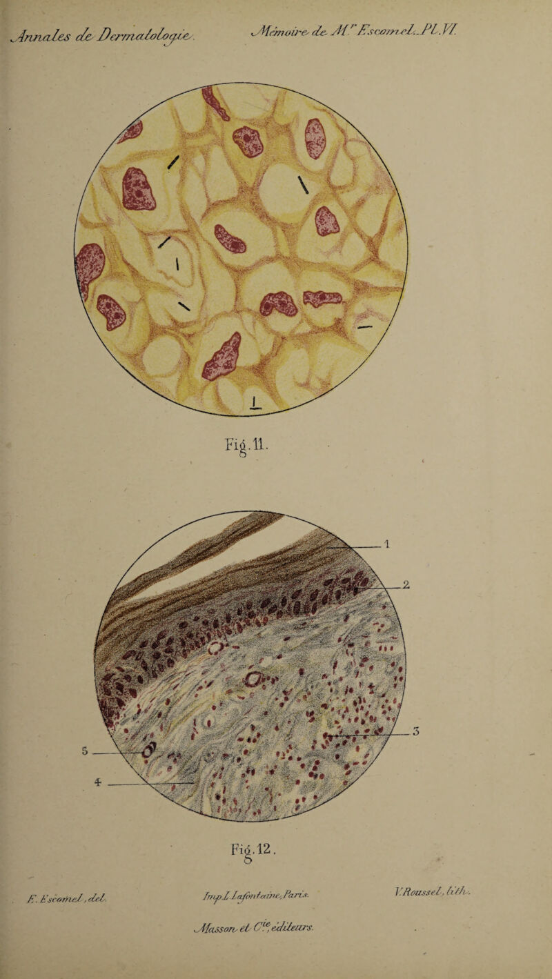 Annales c/e Dermaloloaiey. '^Mànoù~e-' de. /M' J?sc0irveZc.J*L. I f. V- i ^.Massons et C^sttilears.