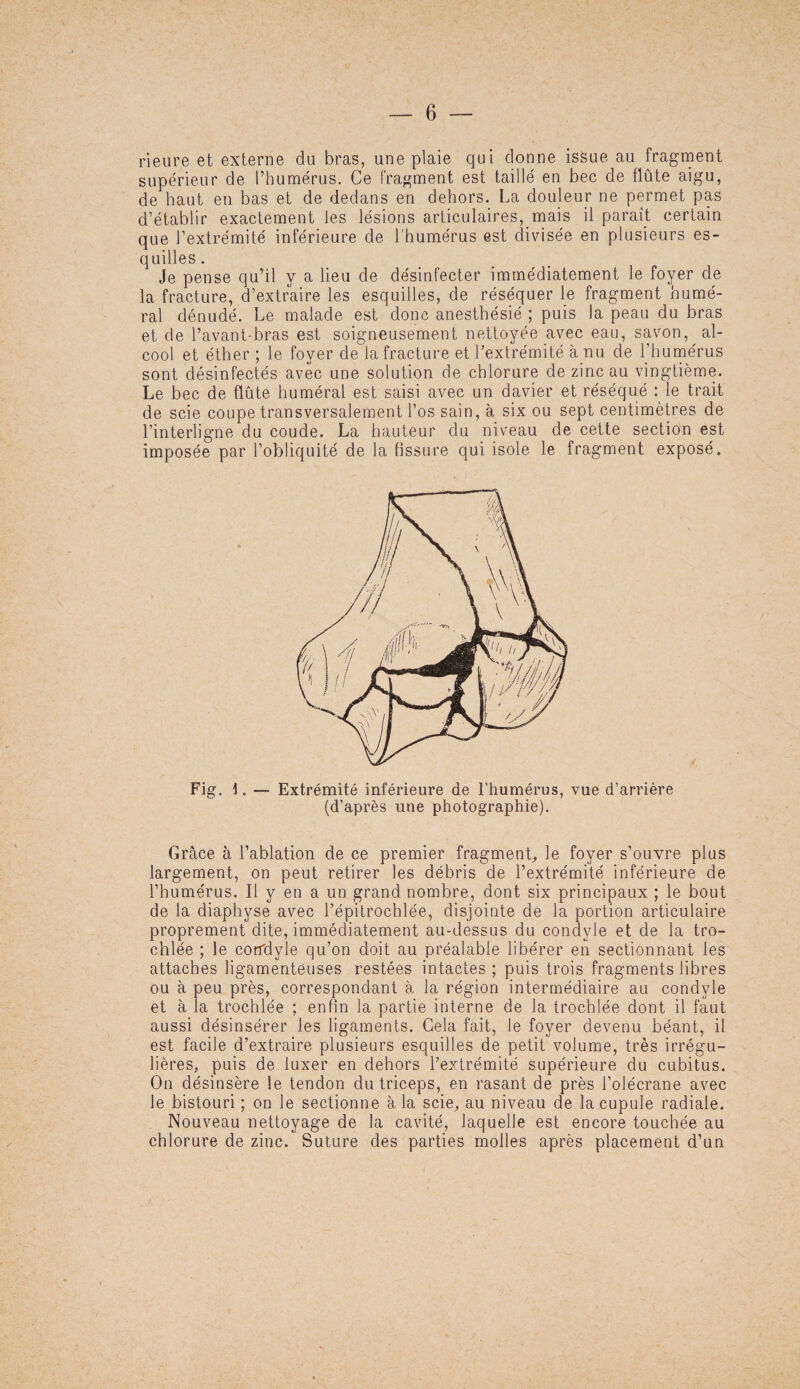 rieure et externe du bras, une plaie qui donne issue au fragment supérieur de l’humérus. Ce fragment est taillé en bec de flûte aigu, de haut en bas et de dedans en dehors. La douleur ne permet pas d’établir exactement les lésions articulaires, mais il paraît certain que l’extrémité inférieure de l’humérus est divisée en plusieurs es¬ quilles . Je pense qu’il y a lieu de désinfecter immédiatement le foyer de la fracture, d’extraire les esquilles, de réséquer le fragment humé¬ ral dénudé. Le malade est donc anesthésié ; puis la peau du bras et de l’avant-bras est soigneusement nettoyée avec eau, savon, al¬ cool et éther ; le foyer de la fracture et l’extrémité à nu de l’humérus sont désinfectés avec une solution de chlorure de zinc au vingtième. Le bec de flûte huméral est saisi avec un davier et réséqué : le trait de scie coupe transversalement l’os sain, à six ou sept centimètres de l’interligne du coude. La hauteur du niveau de cette section est imposée par l’obliquité de la fissure qui isole le fragment exposé. Fig. \. — Extrémité inférieure de l’humérus, vue d’arrière (d’après une photographie). Grâce à l’ablation de ce premier fragment, le foyer s’ouvre plus largement, on peut retirer les débris de l’extrémité inférieure de l’humérus. Il y en a un grand nombre, dont six principaux ; le bout de la diaphyse avec l’épitrochlée, disjointe de la portion articulaire proprement dite, immédiatement au-dessus du condvle et de la tro- chlée ; le corfdyle qu’on doit au préalable libérer en sectionnant les attaches ligamenteuses restées intactes ; puis trois fragments libres ou à peu près, correspondant à la région intermédiaire au condvle et à la trochlée ; enfin la partie interne de la trochlée dont il faut aussi désinsérer les ligaments. Gela fait, le foyer devenu béant, il est facile d’extraire plusieurs esquilles de petit volume, très irrégu¬ lières, puis de luxer en dehors l’extrémité supérieure du cubitus. On désinsère le tendon du triceps, en rasant de près l’olécrane avec le bistouri ; on le sectionne à la scie, au niveau de la cupule radiale. Nouveau nettoyage de la cavité, laquelle est encore touchée au chlorure de zinc. Suture des parties molles après placement d’un