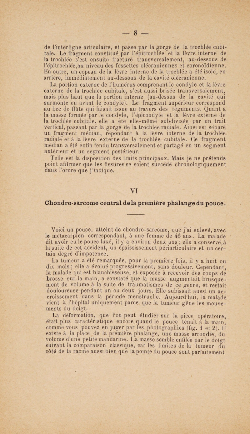 de l’interligne articulaire, et passe par la gorge de la trochlée cubi¬ tale. Le fragment constitué par l’épitrochlée et la lèvre interne de la trochlée s’est ensuite fracturé transversalement, au-dessous de l’épitrochlée,au niveau des fossettes olécraniennes et coronoïdienne. En outre, un copeau de la lèvre interne de la trochlée a été isolé, en arrière, immédiatement au-dessous de la cavité olécranienne. La portion externe de l’humérus comprenant le condyle et la lèvre externe de la trochlée cubitale, s’est aussi brisée transversalement, mais plus haut que la portion interne (au-dessus de la cavité qui surmonte en avant le condyle}. Le fragment supérieur correspond au bec de flûte qui faisait issue au travers des téguments. Quant à la masse formée par le condyle, l’épicondyle et la lèvre externe de la trochlée cubitale, elle a été elle-même subdivisée par un trait vertical, passant par la gorge de la trochlée radiale. Ainsi est séparé un fragment médian, répondant à la lèvre interne de la trochlée radiale et à la lèvre externe de la trochlée cubitale. Ce fragment médian a été enfin fendu transversalement et partagé en un segment antérieur et un segment postérieur. Telle est la disposition des traits principaux. Mais je ne prétends point affirmer que les fissures se soient succédé chronologiquement dans l’ordre que j’indique. VI Chondro sarcome central delà première phalange du pouce. Voici un pouce, atteint de chondro-sarcome, que j’ai enlevé, avec le métacarpien correspondant, à une femme de 46 ans. La malade dit avoir eu le pouce luxé, il y a environ deux ans ; elle a conservera la suite de cet accident, un épaississement périarticulaire et un cer¬ tain degré d’impotence. La tumeur a été remarquée, pour la première fois, il y a huit ou dix mois ; elle a évolué progressivement, sans douleur. Cependant, la malade qui est blanchisseuse, et exposée à recevoir des coups de brosse sur la main, a constaté que la masse augmentait brusque¬ ment de volume à la suite de traumatismes de ce genre, et restait douloureuse pendant un ou deux jours. Elle subissait aussi un ac¬ croissement dans la période menstruelle. Aujourd’hui, la malade vient à l’hôpital uniquement parce que la tumeur gêne les mouve¬ ments du doigt. La déformation, que l’on peut étudier sur la pièce opératoire, était plus caractéristique encore quand le pouce tenait à la main, comme vous pouvez en juger par les photographies (fig. 1 et 2). Il existe à la place de la première phalange, une masse arrondie, du volume d’une petite mandarine. La masse semble enfilée par le doigt suivant la comparaison classique, car les limites de la tumeur du côté de la racine aussi bien que la pointe du pouce sont parfaitement