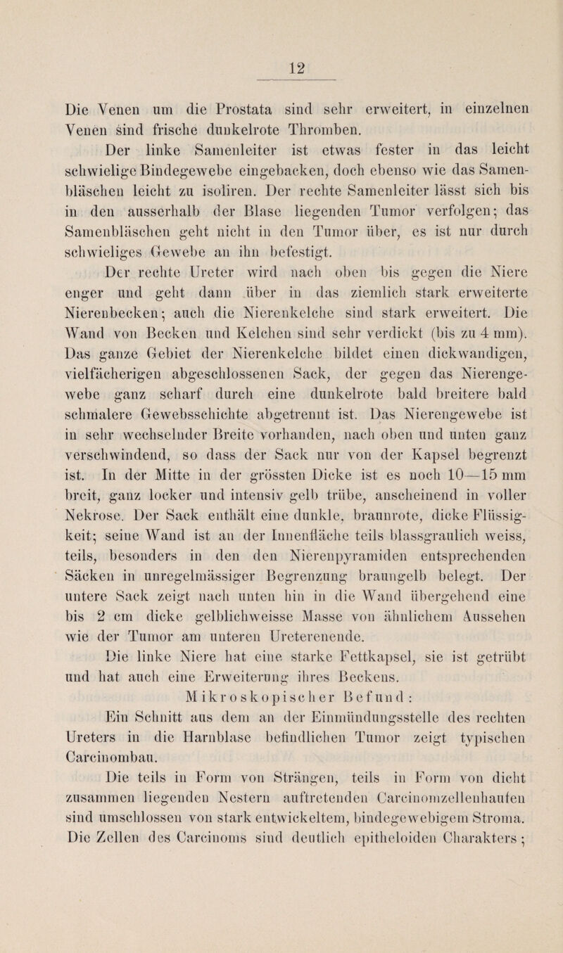 Die Venen um die Prostata sind sehr erweitert, in einzelnen Venen sind frische dunkelrote Thromben. Der linke Samenleiter ist etwas fester in das leicht schwielige Bindegewebe eingebacken, doch ebenso wie das Samen¬ bläschen leicht zu isoliren. Der rechte Samenleiter lässt sich bis in den ausserhalb der Blase liegenden Tumor verfolgen-, das Samenbläschen geht nicht in den Tumor über, es ist nur durch schwieliges Gewebe an ihn befestigt. Der rechte Ureter wird nach oben bis gegen die Niere enger und geht dann über in das ziemlich stark erweiterte Nierenbecken- auch die Nierenkelche sind stark erweitert. Die Wand von Becken und Kelchen sind sehr verdickt (bis zu 4 mm). Das ganze Gebiet der Nierenkelche bildet einen dickwandigen, vielfächerigen abgeschlossenen Sack, der gegen das Nierenge¬ webe ganz scharf durch eine dunkelrote bald breitere bald schmalere Gewebsschichte abgetrennt ist. Das Nierengewebe ist in sehr wechselnder Breite vorhanden, nach oben und unten ganz verschwindend, so dass der Sack nur von der Kapsel begrenzt ist. In der Mitte in der grössten Dicke ist es noch 10—15 mm breit, ganz locker und intensiv gelb trübe, anscheinend in voller Nekrose. Der Sack enthält eine dunkle, braunrote, dicke Flüssig¬ keit; seine Wand ist an der Innenfläche teils blassgraulich weiss, teils, besonders in den den Nierenpyramiden entsprechenden Säcken in unregelmässiger Begrenzung braungelb belegt. Der untere Sack zeigt nach unten hin in die Wand übergehend eine bis 2 cm dicke gelblichweisse Masse von ähnlichem Aussehen wie der Tumor am unteren Ureterenende. Die linke Niere hat eine starke Fettkapsel, sie ist getrübt und hat auch eine Erweiterung ihres Beckens. Mikroskopischer Befund : Ein Schnitt aus dem an der Einmündungsstelle des rechten Ureters in die Harnblase befindlichen Tumor zeigt typischen Carcinombau. Die teils in Form von Strängen, teils in Form von dicht zusammen liegenden Nestern auftretenden Carciuomzellenhaufen sind umschlossen von stark entwickeltem, bindegewebigem Stroma. Die Zellen des Carcinoms siud deutlicli epitheloiden Charakters ;