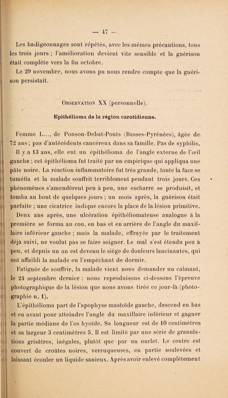 1 1 f: i\\ 1 :: d ] Mj üli % Les badigeonnages sont répétés, avec les mêmes précautions, tous les trois jours ; l’amélioration devient vite sensible et la guérison était complète vers la fin octobre. Le 29 novembre, nous avons pu nous rendre compte que la guéri¬ son persistait. Observation XX (personnelle). * Epithélioma de la région carotidienne. Femme L..., de Ponson-Debat-Pouts (Basses-Pyrénées), âgée de 72 ans ; pas d’antécédents cancéreux dans sa famille. Pas de syphilis. Il y a 13 ans, elle eut un épithélioma de l’angle externe de l’œil gauche ; cet épithélioma fut traité par un empirique qui appliqua une pâte noire. La réaction inflammatoire fut très grande, toute la face se tuméfia et la malade souffrit terriblement pendant trois jours. Ces phénomènes s’amendèrent peu à peu, une escharre se produisit, et tomba au bout de quelques jours ; un mois après, la guérison était parfaite ; une cicatrice indique encore la place de la lésion primitive. Deux ans après, une ulcération épithéliomateuse analogue à la première se forma au cou, en bas et en arrière de l’angle du maxil¬ laire inférieur gauche ; mais la malade, effrayée par le traitement déjà suivi, ne voulut pas se faire soigner. Le mal s’est étendu peu à peu, et depuis un an est devenu le siège de douleurs lancinantes, qui ont affaibli la malade en l’empêchant de dormir. Fatiguée de souffrir, la malade vient nous demander un calmant, le 24 septembre dernier : nous reproduisons ci-dessous l’épreuve photographique de la lésion que nous avons tirée ce jour-là (photo¬ graphie n. 1). L’épithélioma part de l’apophyse mastoïde gauche, descend en bas et en avant pour atteindre l’angle du maxillaire inférieur et gagner la partie médiane de l’os hyoïde. Sa longueur est de 10 centimètres et sa largeur 3 centimètres 5. Il est limité par une série de granula¬ tions grisâtres, inégales, plutôt que par un ourlet. Le centre est couvert de croûtes noires, verruqueuses, en partie soulevées et laissant écouler un liquide sanieux. Après avoir enlevé complètement