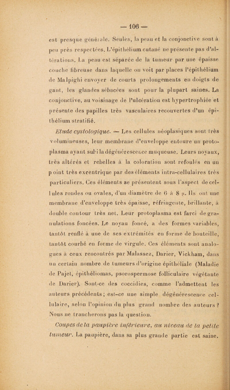 est presque généiale. Seules, la peau et la conjonctive sont à peu près respectées. L’épithélium cutané ne présente pas d’al- térations. La peau est séparée de la tumeur par une épaisse couche fibreuse dans laquelle on voit par places l’épithélium de Malpighi envoyer de courts prolongements en doigts de gant, les glandes sébacées sont pour la plupart saines. La conjonctive, au voisinage de l’ulcération est hypertrophiée et présente des papilles très vasculaires recouvertes d’un épi¬ thélium stratifié. Etude cystologique. — Les cellules néoplasiques sont très volumineuses, leur membrane d’enveloppe entoure un proto¬ plasma ayant subi la dégénérescence muqueuse. Leurs noyaux, très altérés et rebelles à la coloration sont refoulés en un point très excentrique par des éléments intra-cellulaires très particuliers. Ces éléments se présentent sous l’aspect de cel¬ lules rondes ou ovales, d’un diamètre de 6 à 8 [x. Ils ont une membrane d’enveloppe très épaisse, réfringente, brillante, à double contour très net. Leur protoplasma est farci de gra¬ nulations foncées. Le noyau foncé-, a des formes variables, tantôt renflé à une de ses extrémités en forme de bouteille, tantôt courbé en forme de virgule. Ces éléments sont analo¬ gues à ceux rencontrés parMalassez, Darier, Vickham, dans un certain nombre de tumeurs d’origine épithéliale (Maladie de Pajet, épithéliomas, psorospermose folliculaire végétante de Darier). Sont-ce des coccidies, comme l’admettent les auteurs précédents; est-ce une simple dégénérescence cel¬ lulaire, selon l’opinion du plus grand nombre des auteurs ? Nous ne trancherons pas la question. Coupes delà paupière inférieure, au niveau de la petite tumeur. La paupière, dans sa plus grande partie est saine.