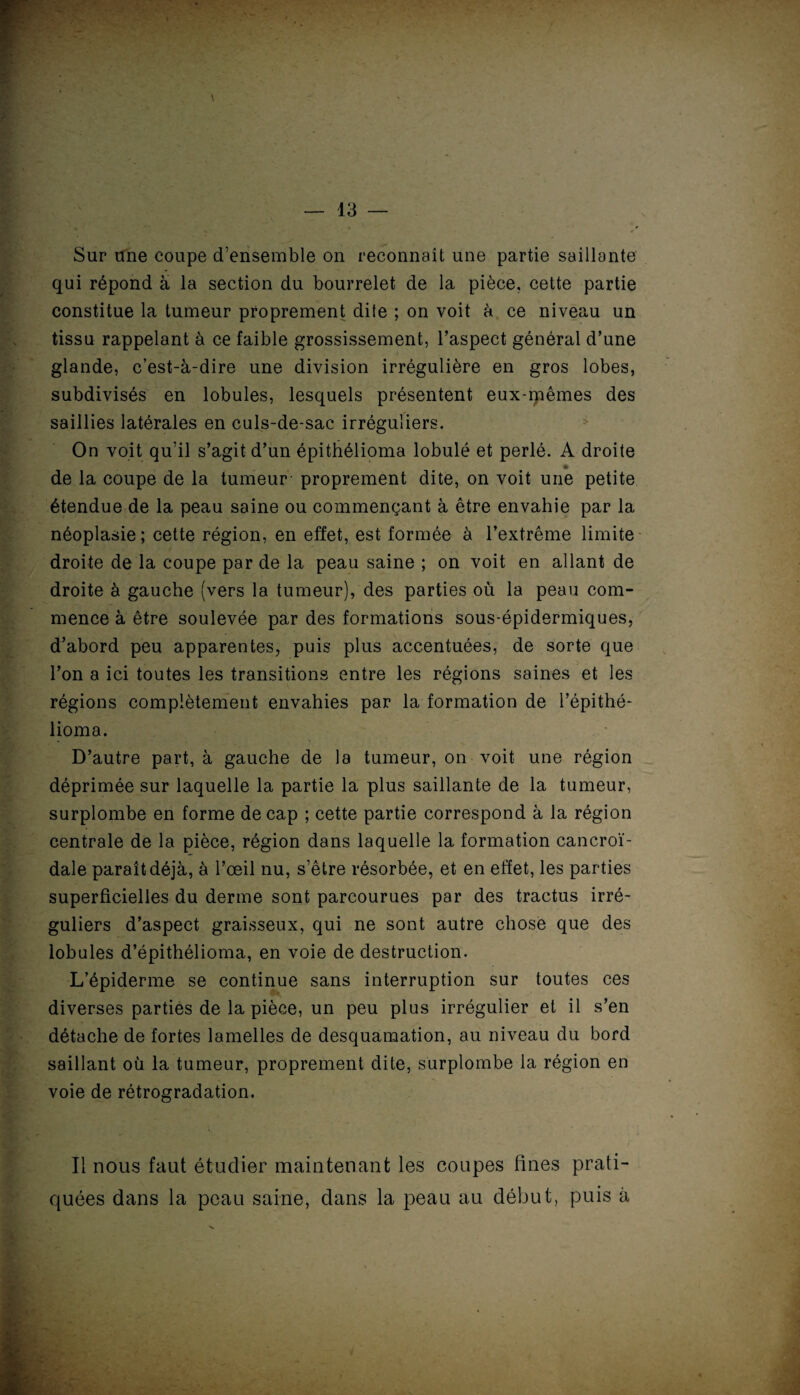 Sur une coupe d’ensemble on reconnaît une partie saillante qui répond à la section du bourrelet de la pièce, cette partie constitue la tumeur proprement dite ; on voit à ce niveau un tissu rappelant à ce faible grossissement, l’aspect général d’une glande, c’est-à-dire une division irrégulière en gros lobes, subdivisés en lobules, lesquels présentent eux-mêmes des saillies latérales en culs-de-sac irréguliers. On voit qu’il s’agit d’un épithélioma lobulé et perlé. A droite de la coupe de la tumeur- proprement dite, on voit une petite étendue de la peau saine ou commençant à être envahie par la néoplasie; cette région, en effet, est formée à l’extrême limite droite de la coupe par de la peau saine ; on voit en allant de droite à gauche (vers la tumeur), des parties où la peau com¬ mence à être soulevée par des formations sous-épidermiques, d’abord peu apparentes, puis plus accentuées, de sorte que l’on a ici toutes les transitions entre les régions saines et les régions complètement envahies par la formation de l’épithé- lioma. D’autre part, à gauche de la tumeur, on voit une région déprimée sur laquelle la partie la plus saillante de la tumeur, surplombe en forme de cap ; cette partie correspond à la région centrale de la pièce, région dans laquelle la formation cancroï- dale paraît déjà, à l’œil nu, s’être résorbée, et en effet, les parties superficielles du derme sont parcourues par des tractus irré¬ guliers d’aspect graisseux, qui ne sont autre chose que des lobules d’épithélioma, en voie de destruction. L’épiderme se continue sans interruption sur toutes ces diverses parties de la pièce, un peu plus irrégulier et il s’en détache de fortes lamelles de desquamation, au niveau du bord saillant où la tumeur, proprement dite, surplombe la région en voie de rétrogradation. Il nous faut étudier maintenant les coupes fines prati¬ quées dans la peau saine, dans la peau au début, puis à