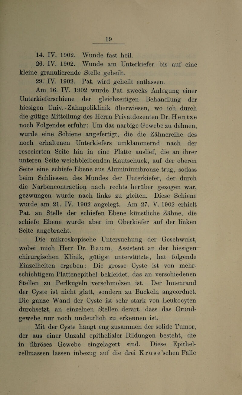 14. IV. 1902. Wunde fast heil. 26. IV. 1902. Wunde am Unterkiefer bis auf eine kleine granulierende Stelle geheilt. 29. IV. 1902. Pat. wird geheilt entlassen. Am 16. IV. 1902 wurde Pat. zwecks Anlegung einer Unterkieferschiene der gleichzeitigen Behandlung der hiesigen Univ. - Zahnpoliklinik überwiesen, wo ich durch die gütige Mitteilung des Herrn Privatdozenten Dr. Hentze noch Folgendes erfuhr: Um das narbige Gewebe zu dehnen, wurde eine Schiene angefertigt, die die Zähnereihe des noch erhaltenen Unterkiefers umklammernd nach der resecierten Seite hin in eine Platte auslief, die an ihrer unteren Seite weichbleibenden Kautschuck, auf der oberen Seite eine schiefe Ebene aus Aluminiumbronze trug, sodass beim Schliessen des Mundes der Unterkiefer, der durch die Narbencontraction nach rechts herüber gezogen war, gezwungen wurde nach links zu gleiten. Diese Schiene wurde am 21. IV. 1902 angelegt. Am 27. V. 1902 erhielt Pat. an Stelle der schiefen Ebene künstliche Zähne, die schiefe Ebene wurde aber im Oberkiefer auf der linken Seite angebracht. Die mikroskopische Untersuchung der Geschwulst, wobei mich Herr Dr. Baum, Assistent an der hiesigen chirurgischen Klinik, gütigst unterstützte, hat folgende Einzelheiten ergeben: Die grosse Cyste ist von mehr¬ schichtigem Plattenepithel bekleidet, das an verschiedenen Stellen zu Perlkugeln verschmolzen ist. Der Innenrand der Cyste ist nicht glatt, sondern zu Buckeln angeordnet. Die ganze Wand der Cyste ist sehr stark von Leukocyten durchsetzt, an einzelnen Stellen derart, dass das Grund¬ gewebe nur noch undeutlich zu erkennen ist. Mit der Cyste hängt eng zusammen der solide Tumor, der aus einer Unzahl epithelialer Bildungen besteht, die in fibröses Gewebe eingelagert sind. Diese Epithel¬ zellmassen lassen inbezug auf die drei Kruse’schen Fälle