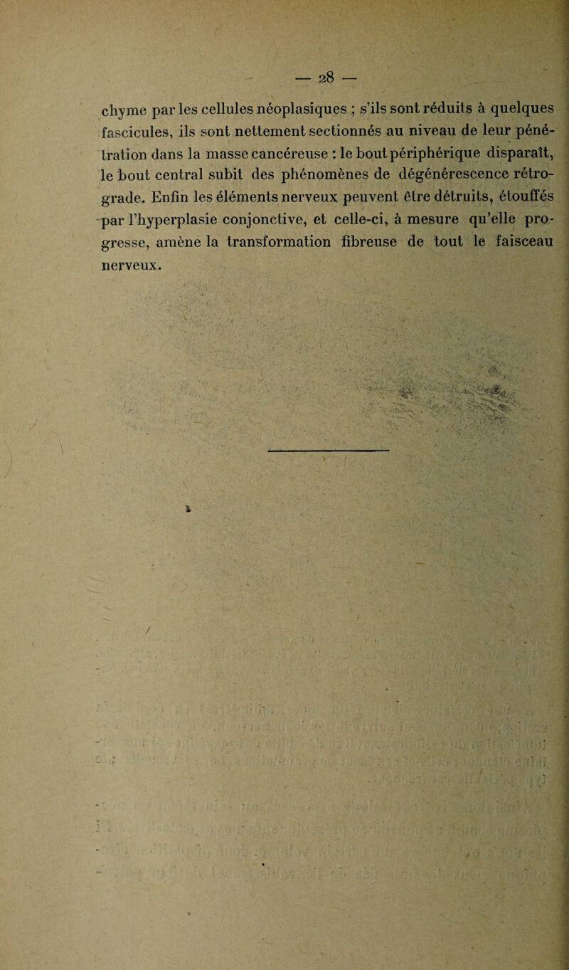chyme par les cellules néoplasiques ; s’ils sont réduits à quelques fascicules, ils sont nettement sectionnés au niveau de leur péné¬ tration dans la masse cancéreuse : le bout périphérique disparaît, le bout central subit des phénomènes de dégénérescence rétro- ■ grade. Enfin les éléments nerveux peuvent être détruits, étouffés par l’hyperplasie conjonctive, et celle-ci, à mesure qu’elle pro¬ gresse, amène la transformation fibreuse de tout le faisceau nerveux.