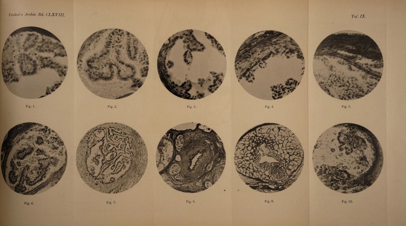 Virchows Archiv Bd. CLXVII1. Taf. IX. Fig. 6. Fig; 7. Fig. 8. Fig. 9. Fig. 10. t's