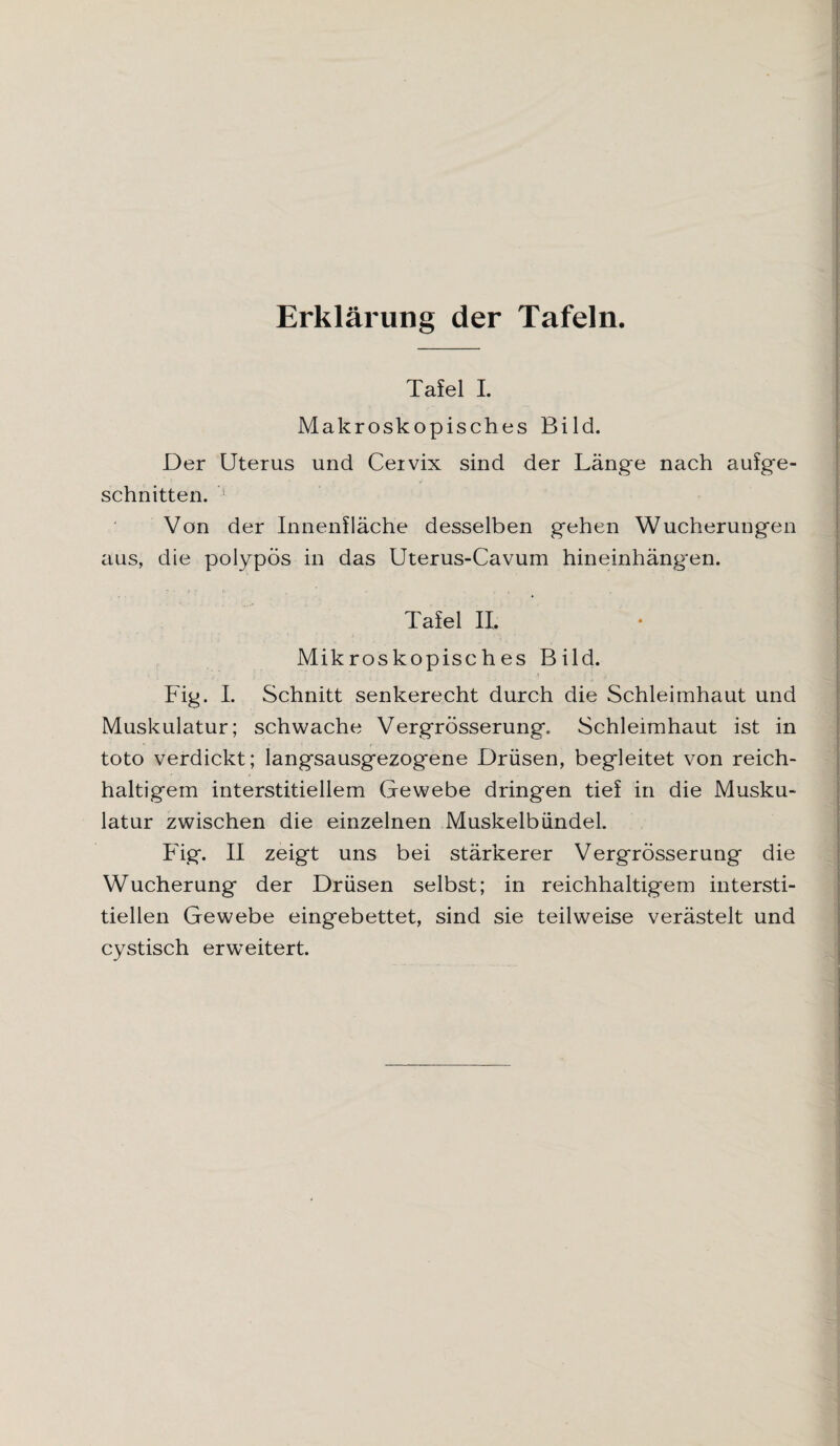 Erklärung der Tafeln. Tafel I. Makroskopisches Bild. Der Uterus und Ceivix sind der Länge nach aufge¬ schnitten. Von der Innenfläche desselben gehen Wucherungen aus, die polypös in das Uterus-Cavum hineinhängen. Tafel II, Mikroskopisches Bild. Fig. I. Schnitt senkerecht durch die Schleimhaut und Muskulatur; schwache Vergrösserung. Schleimhaut ist in toto verdickt; langsausgezogene Drüsen, begleitet von reich¬ haltigem interstitiellem Gewebe dringen tief in die Musku¬ latur zwischen die einzelnen Muskelbündel. Fig. II zeigt uns bei stärkerer Vergrösserung die Wucherung der Drüsen selbst; in reichhaltigem intersti¬ tiellen Gewebe eingebettet, sind sie teilweise verästelt und cystisch erweitert.