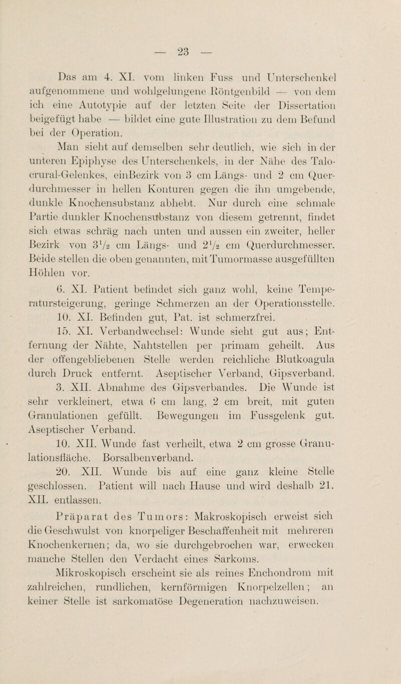 Das am 4. XI. vom linken Fuss und Unterschenkel aufgenommene und wohlgelungene Röntgenbild — von dem ich eine Autotypie auf der letzten Seite der Dissertation beigefügt habe — bildet eine gute Illustration zu dem Befund bei der Operation. Man sieht auf demselben sehr deutlich, wie sich in der unteren Epiphyse des Unterschenkels, in der Nähe des Talo- crural-Gelenkes, einBezirk von 3 cm Längs- und 2 cm Quer¬ durchmesser in hellen Konturen gegen die ihn umgebende, dunkle Knochensubstanz abhebt. Nur durch eine schmale Partie dunkler Knochensubstanz von diesem getrennt, findet sich etwas schräg nach unten und aussen ein zweiter, heller Bezirk von 3 lA cm Längs- und 2 l/s cm Querdurchmesser. Beide stellen die oben genannten, mit Tumormasse ausgefüllten Höhlen vor. 6. XI. Patient befindet sich ganz wohl, keine Tempe¬ ratu rsteigerung, geringe Schmerzen an der Operationsstelle. 10. XI. Befinden gut, Pat. ist schmerzfrei. 15. XI. Verbandwechsel: Wunde sieht gut aus; Ent¬ fernung der Nähte, Nahtstellen per primam geheilt. Aus der offengebliebenen Stelle werden reichliche Blutkoagula durch Druck entfernt. Aseptischer Verband, Gipsverband. 3. XII. Abnahme des Gipsverbandes. Die Wunde ist sehr verkleinert, etwa 0 cm lang, 2 cm breit, mit guten Granulationen gefüllt. Bewegungen im Fussgelenk gut. Aseptischer Verband. 10. XII. Wunde fast verheilt, etwa 2 cm grosse Granu- lationsfiäche. Borsalbenverband. 20. XII. Wunde bis auf eine ganz kleine Stelle geschlossen. Patient will nach Hause und wird deshalb 21. XII. entlassen. Präparat des Tumors: Makroskopisch erweist sich die Geschwulst von knorpeliger Beschaffenheit mit mehreren Knochenkernen; da, wo sie durchgebrochen war, erwecken manche Stellen den Verdacht eines Sarkoms. Mikroskopisch erscheint sie als reines Enchondrom mit zahlreichen, rundlichen, kernförmigen Knorpelzellen; an keiner Stelle ist sarkomatöse Degeneration nachzuweisen.