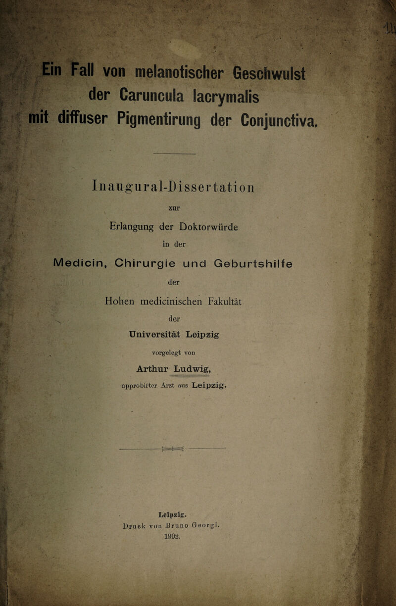 Ein Fall von melanotischer Geschwulst der Caruncula lacrymalis mit diffuser Pigmentirung der Conjunctiva, Inaugural-Dissertation zur Erlangung der Doktorwürde in der Medicin, Chirurgie und Geburtshilfe der Hohen medicinischen Fakultät ^ der Universität Leipzig vorgelegt von Arthur Ludwig, approbirter Arzt aus Leipzig. Leipzig, Druck von Bruno Georgi. 1902.