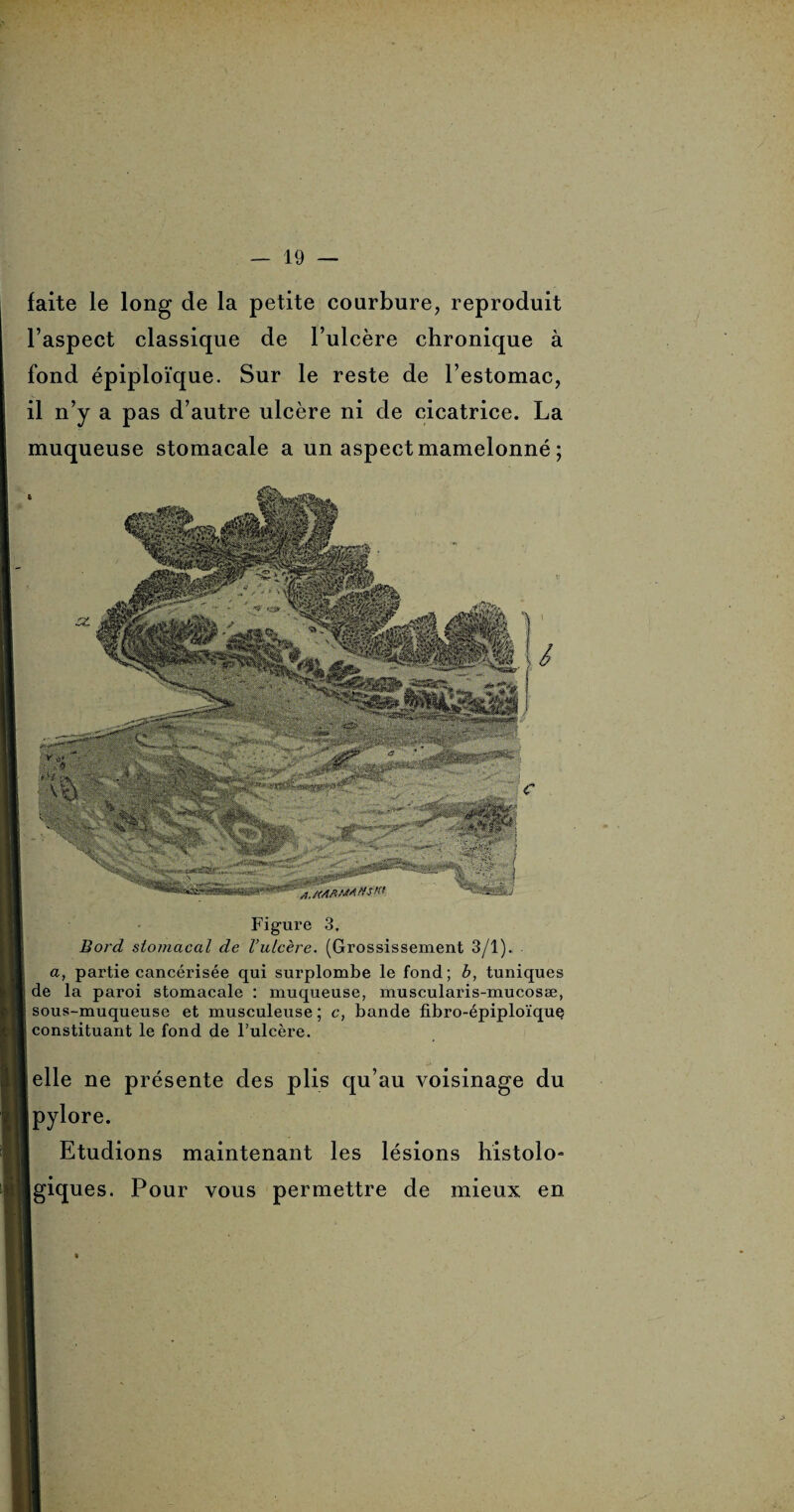 faite le long de la petite courbure, reproduit l’aspect classique de l’ulcère chronique à fond épiploïque. Sur le reste de l’estomac, il n’y a pas d’autre ulcère ni de cicatrice. La muqueuse stomacale a un aspect mamelonné ; Figure 3. Bord stomacal de l’ulcère. (Grossissement 3/1). a, partie cancérisée qui surplombe le fond; b, tuniques de la paroi stomacale : muqueuse, muscularis-mucosæ, sous-muqueuse et musculeuse ; c, bande fibro-épiploïque constituant le fond de l’ulcère. elle ne présente des plis qu’au voisinage du pylore. Etudions maintenant les lésions histolo- igiques. Pour vous permettre de mieux en