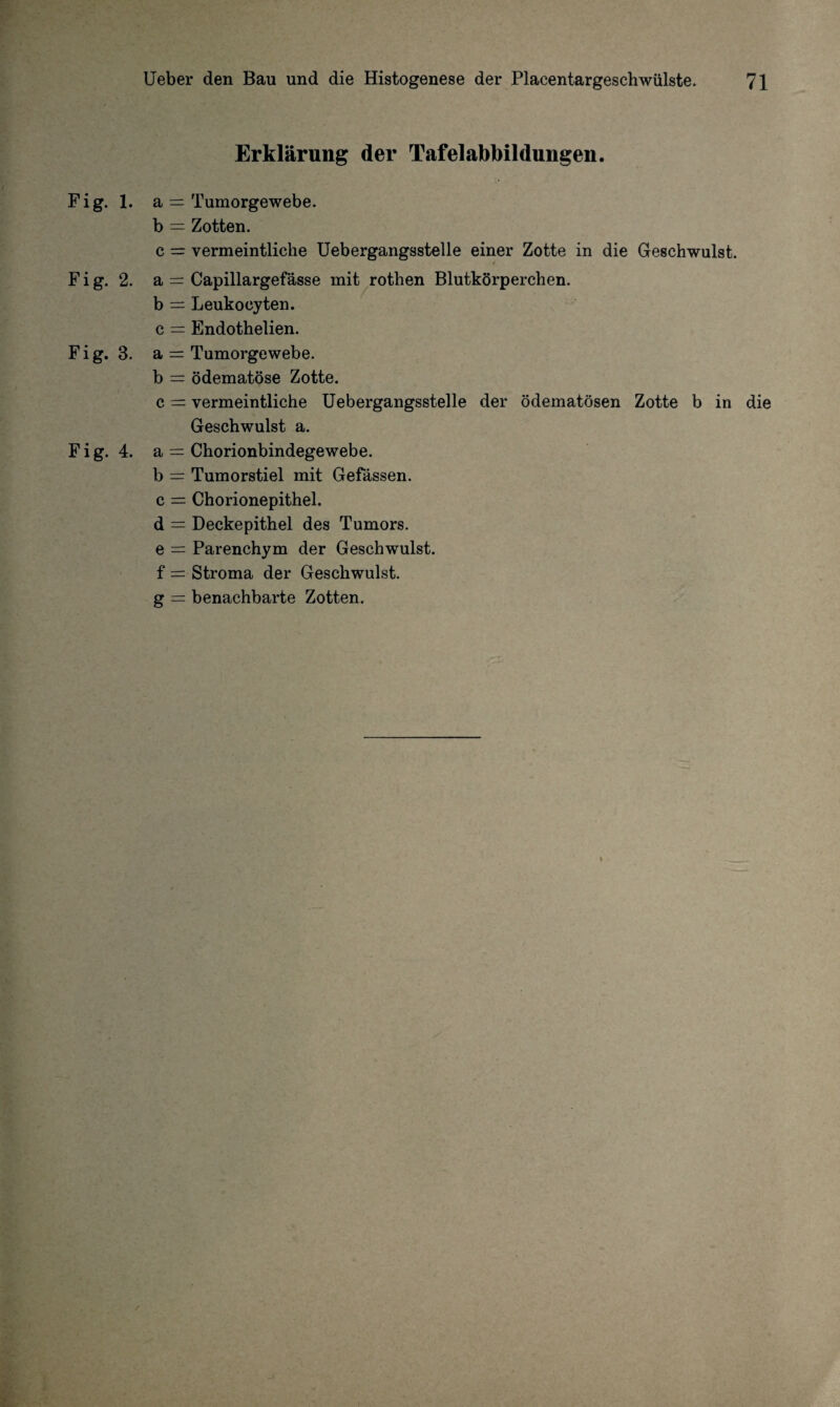 Erklärung der Tafel abbildungen. Fig. 1. a = Tumorgewebe, b = Zotten. c = vermeintliche Uebergangsstelle einer Zotte in die Geschwulst. F i g. 2. a = Capillargefässe mit rothen Blutkörperchen, b = Leukocyten. c = Endothelien. F i g. 3. a = Tumorgewebe. b = ödematöse Zotte. c = vermeintliche Uebergangsstelle der ödematösen Zotte b in die Geschwulst a. F i g. 4. a = Chorionbindegewebe. b = Tumorstiel mit Gefässen. c = Chorionepithel, d = Deckepithel des Tumors, e — Parenchym der Geschwulst, f = Stroma der Geschwulst, g = benachbarte Zotten. /