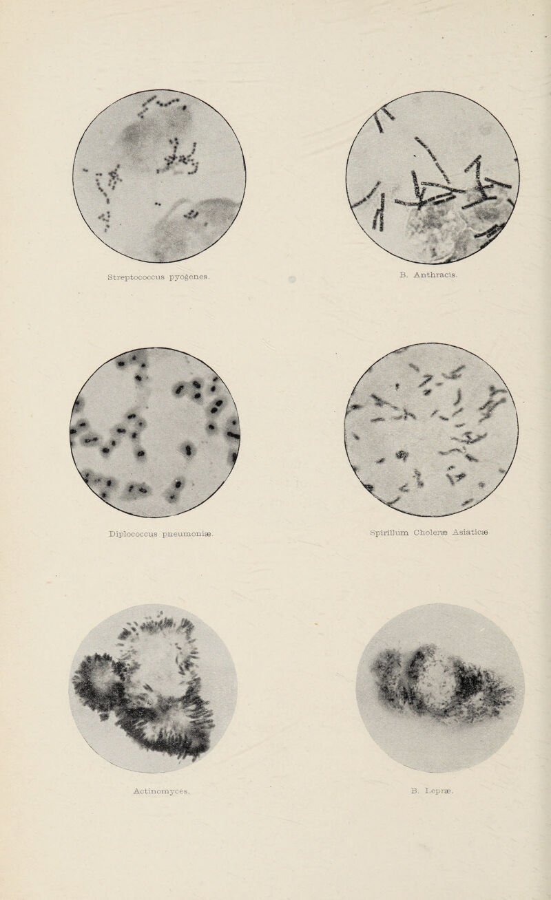 Streptococcus pyogenes. Diplococcus pneumoniae. Spirillum Ciaolerse Asiatic® Actinomyces. B. Leprae.