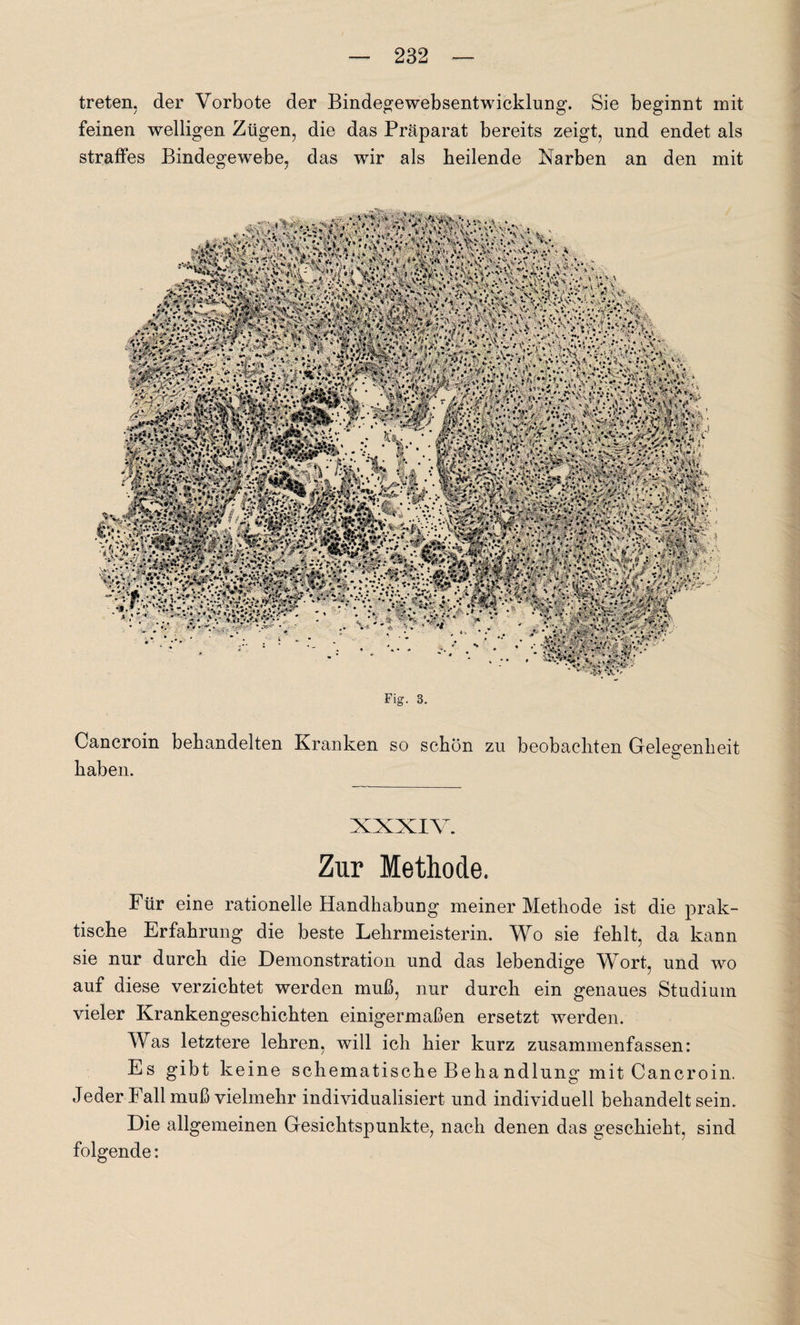 treten, der Vorbote der Bindegewebsentwicklung. Sie beginnt mit feinen welligen Zügen, die das Präparat bereits zeigt, und endet als straffes Bindegewebe, das wir als heilende Narben an den mit Fig. 3. Cancroin behandelten Kranken so schön zu beobachten Gelegenheit haben. XXXIV. Zur Methode. Für eine rationelle Handhabung meiner Methode ist die prak¬ tische Erfahrung die beste Lehrmeisterin. Wo sie fehlt, da kann sie nur durch die Demonstration und das lebendige Wort, und wo auf diese verzichtet werden muß, nur durch ein genaues Studium vieler Krankengeschichten einigermaßen ersetzt werden. Was letztere lehren, will ich hier kurz zusammenfassen: Es gibt keine schematische Behandlung mit Cancroin. Jeder Fall muß vielmehr individualisiert und individuell behandelt sein. Die allgemeinen Gesichtspunkte, nach denen das geschieht, sind folgende: