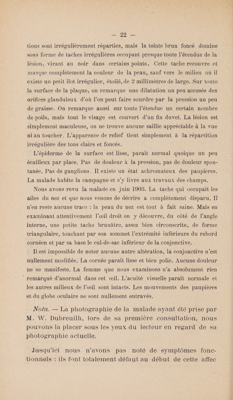 tions sont irrégulièrement réparties, mais la teinte brun foncé domine sous forme de taches irrégulières occupant presque toute F étendue de la lésion, virant au noir dans certains points. Cette tache recouvre et masque complètement la couleur de la peau, sauf vers le milieu où il existe un petit îlot irrégulier, étoilé, de 2 millimètres de large. Sur toute la surface de la plaque, on remarque une dilatation un peu accusée des orifices glanduleux d’où l’on peut faire sourdre par la pression un peu de graisse. On remarque aussi sur toute l’étendue un certain nombre de poils, mais tout le visage est couvert d’un fin duvet. La lésion est simplement maculeuse, on ne trouve aucune saillie appréciable à la vue ni au toucher. L’apparence de relief tient simplement à la répartition irrégulière des tons clairs et foncés. L’épiderme de la surface est lisse, paraît normal quoique un peu écailleux par place. Pas de douleur à la pression, pas de douleur spon¬ tanée. Pas de ganglions. Il existe un état achromateux des paupières. La malade habite la campagne et s’j livre aux travaux des champs. Nous avons revu la malade en juin 1903. La tache qui occupait les ailes du nez et que nous venons de décrire a complètement disparu. Il n’en reste aucune trace : la peau du nez est tout à fait saine. Mais en examinant attentivement l’œil droit on y découvre, du côté de l’angle interne, une petite tache brunâtre, assez bien circonscrite, de forme triangulaire, touchant par son sommet l’extrémité inférieure du rebord cornéen et par sa base le cul-de-sac inférieur de la conjonctive. Il est impossible de noter aucune autre altération, la conjonctive n’est nullement modifiée. La cornée paraît lisse et bien polie. Aucune douleur ne se manifeste. La femme que nous examinons n’a absolument rien remarqué d’anormal dans cet œil. L’acuité visuelle paraît normale et les autres milieux de l’œil sont intacts. Les mouvements des paupières et du globe oculaire ne sont nullement entravés. Nota. — La photographie de la malade ayant été prise par M. W. Dubreuilh, lors de sa première consultation, nous pouvons la placer sous les yeux, du lecteur en regard de sa photographie actuelle. Jusqu’ici nous n’avons pas noté de symptômes fonc¬ tionnels : ils font totalement défaut au début de cette affec