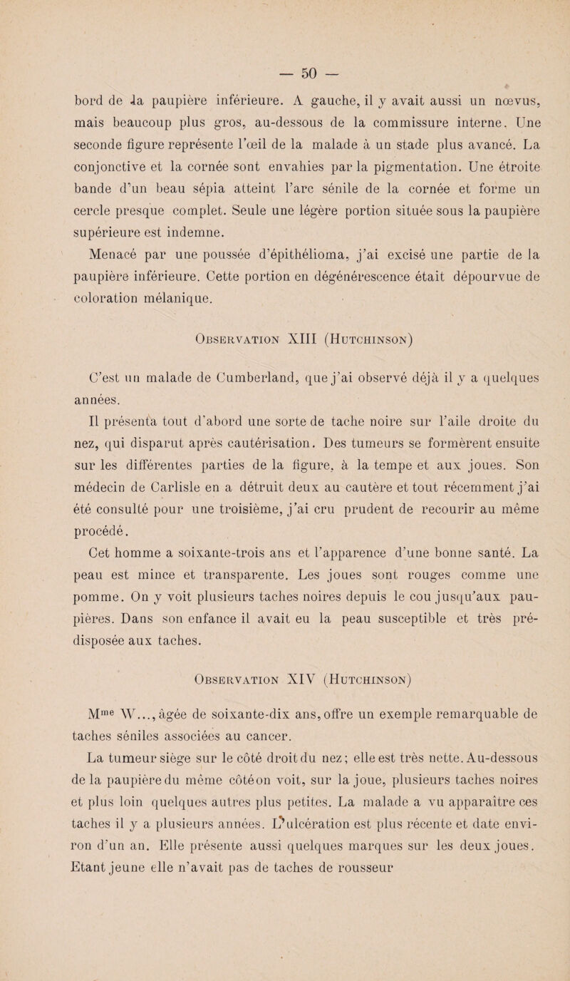 bord de .la paupière inférieure. A gauche, il y avait aussi un nœvus, mais beaucoup plus gros, au-dessous de la commissure interne. Une seconde figure représente l’œil de la malade à un stade plus avancé. La conjonctive et la cornée sont envahies parla pigmentation. Une étroite bande d’un beau sépia atteint l’arc sénile de la cornée et forme un cercle presque complet. Seule une légère portion située sous la paupière supérieure est indemne. Menacé par une poussée d’épithélioma, j’ai excisé une partie de la paupière inférieure. Cette portion en dégénérescence était dépourvue de coloration mélanique. Observation XIII (Hutchinson) C’est un malade de Cumberland, que j’ai observé déjà il y a quelques années. Il présenta tout d’abord une sorte de tache noire sur l’aile droite du nez, qui disparut après cautérisation. Des tumeurs se formèrent ensuite sur les différentes parties de la figure, à la tempe et aux joues. Son médecin de Carliste en a détruit deux au cautère et tout récemment j’ai été consulté pour une troisième, j’ai cru prudent de recourir au même procédé. Cet homme a soixante-trois ans et l’apparence d’une bonne santé. La peau est mince et transparente. Les joues sont rouges comme une pomme. On y voit plusieurs taches noires depuis le cou jusqu’aux pau¬ pières. Dans son enfance il avait eu la peau susceptible et très pré¬ disposée aux taches. Observation XIV (Hutchinson) Mme W...,âgée de soixante-dix ans,offre un exemple remarquable de taches séniles associées au cancer. La tumeur siège sur le côté droit du nez; elle est très nette. Au-dessous delà paupière du même côtéon voit, sur la joue, plusieurs taches noires et plus loin quelques autres plus petites. La malade a vu apparaître ces taches il y a plusieurs années. L*’ulcération est plus récente et date envi¬ ron d’un an. Elle présente aussi quelques marques sur les deux joues. Etant jeune elle n’avait pas de taches de rousseur