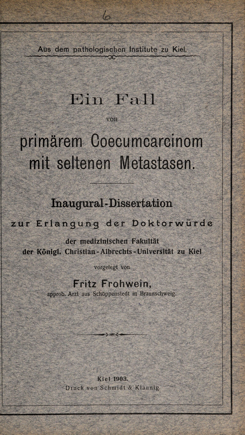 Aus dem pathologischen Institute zu Kiel. - ——--—y*~~~**-*~——— 4i£r¥~^L:Jy. ■ I Jcglgl Inauguxal-Dissertation zur Erlangung der Doktorwürde der medizinischen Fakultät der Königl« Christian-Albrechts-Universität zu Kiel ’ vorgelegt von / ^ Fritz Frohwein, Arzt aus Schöppenstedt in Braunschweig. Kiel 1903. Druck von Schmidt & Klaunig.