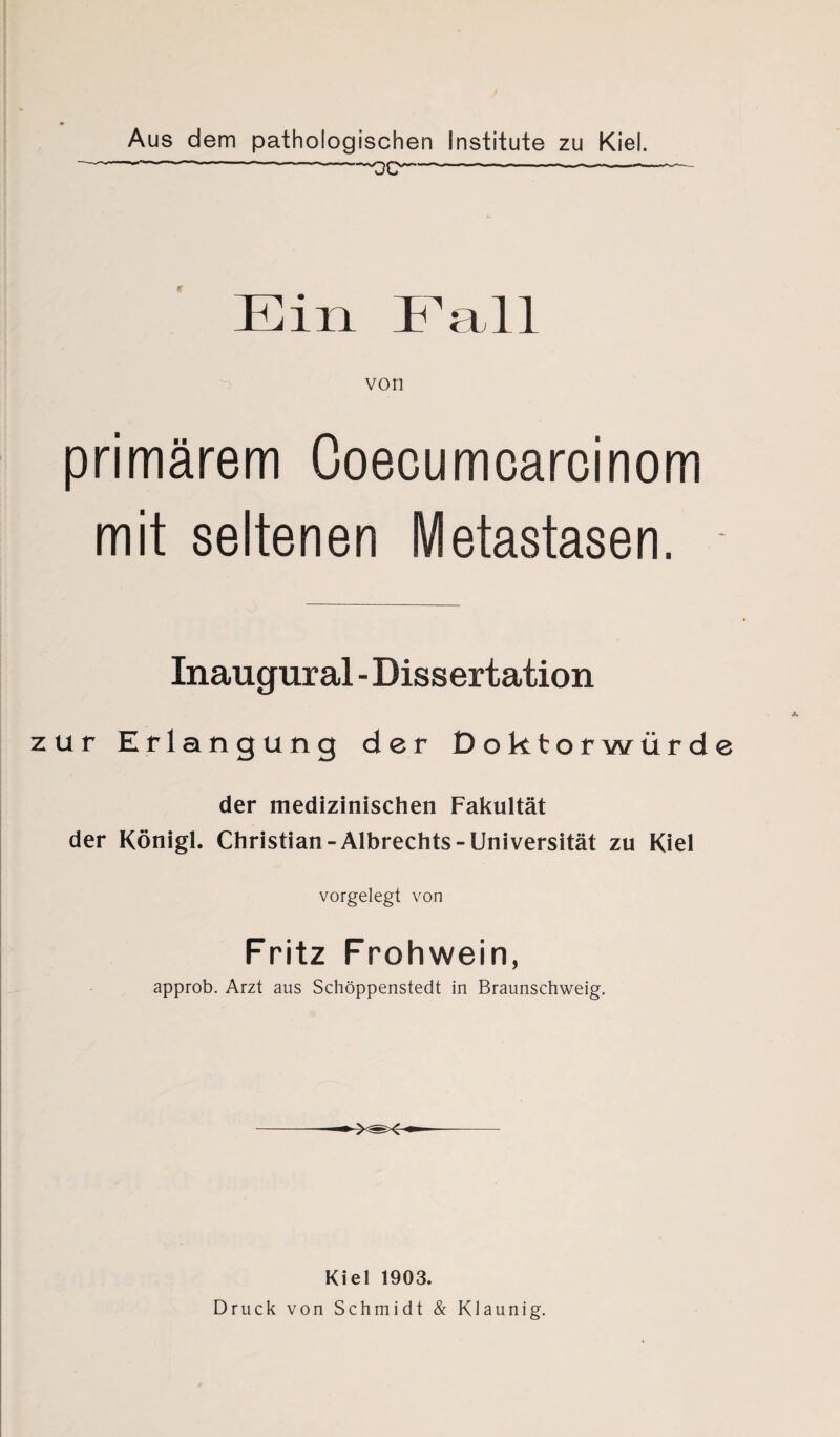 Aus dem pathologischen Institute zu Kiel. — 'W. I — - - ■ 0~*m ■ - -~ — Ein Fall von primärem Coecumcarcinom mit seltenen Metastasen. Inaugural - Dissertation zur Erlangung der Doktorwürde der medizinischen Fakultät der Königl. Christian-Albrechts-Universität zu Kiel vorgelegt von Fritz Frohwein, approb. Arzt aus Schöppenstedt in Braunschweig. Kiel 1903. Druck von Schmidt & Klaunig.