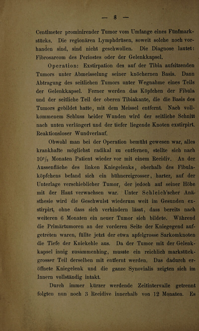 Centimeter prominirender Tumor vom Umfange eines Fünfmark¬ stücks. Die regionären Lymphdrüsen, soweit solche noch vor- handen sind, sind nicht geschwollen. Die Diagnose lautet: Fibrosarcom des Periostes oder der Gelenkkapsel. Operation: Exstirpation des auf der Tibia aufsitzenden Tumors unter Abmeisselung seiner knöchernen Basis. Dann Abtragung des seitlichen Tumors unter Wegnahme eines Teils der Gelenkkapsel. Ferner werden das Köpfchen der Fibula und der seitliche Teil der oberen Tibiakante, die die Basis des Tumors gebildet hatte, mit dem Meissei entfernt. Nach voll¬ kommenem Schluss beider Wunden wird der seitliche Schnitt nach unten verlängert und der tiefer liegende Knoten exstirpirt. Reaktionsloser Wund verlauf. Obwohl man bei der Operation bemüht gewesen war, alles krankhafte möglichst radikal zu entfernen, stellte sich nach IOV2 Monaten Patient wieder vor mit einem Recidiv. An der Aussenfläche des linken Kniegelenks, oberhalb des Fibula¬ köpfchens befand sich ein hühnereigrosser, harter, auf der Unterlage verschieblicher Tumor, der jedoch auf seiner Höhe mit der Haut verwachsen war. Unter Schleich’scher Anä¬ sthesie wird die Geschwulst wiederum weit im Gesunden ex¬ stirpirt, ohne dass sich verhindern lässt, dass bereits nach weiteren 6 Monaten ein neuer Tumor sich bildete. Während die Primärtumoren an der vorderen Seite der Kniegegend auf- getreten waren, füllte jetzt der etwa apfelgrosse Sarkomknoten die Tiefe der Kniekehle aus. Da der Tumor mit der Gelenk¬ kapsel innig zusammenhing, musste ein reichlich markstück- grosser Teil derselben mit entfernt werden. Das dadurch er¬ öffn ete Kniegelenk und die ganze Synovialis zeigten sich im Innern vollständig intakt. Durch immer kürzer werdende Zeitintervalle getrennt folgten nun noch 3 Iiecidive innerhalb von 12 Monaten. Es