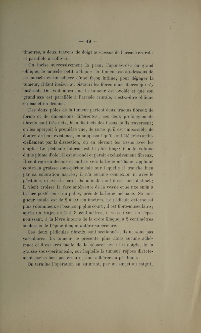 timètres, à deux travers de doigt au-dessus de l’arcade crurale et parallèle à celle-ci. On incise successivement la peau, l’aponévrose du grand oblique, le muscle petit oblique; la tumeur est au-dessous de ce muscle et lui adhère d’une façoo intime; pour dégager la tumeur, il faut inciser au bistouri les fibres musculaires qui s’y insèrent. On voit alors que la tumeur est ovoïde et que son grand axe est parallèle à l’arcade crurale, c’est-à-dire oblique en bas et en dedans. Des deux pôles de la tumeur partent deux tractus fibreux de forme et de dimensions différentes ; ces deux prolongements fibreux sont très nets, bien distincts des tissus qu’ils traversent; on les aperçoit à première vue, de sorte qu’il est impossible de douter de leur existence, en supposant qu'ils ont été créés artifi¬ ciellement par la dissection, ou en élevant les tissus avec les doigts. Le pédicule interne est le plus long; il a le volume d’une plume d’oie ; il est arrondi et paraît exclusivement fibreux. Il se dirige en dedans et en bas vers la ligne médiane, appliqué contre la graisse sous-péritonéale sur laquelle il tranche bien par sa coloration nacrée ; il n’a aucune connexion ni avec le péritoine, ni avec la paroi abdominale dont il est bien distinct ; il vient croiser la face antérieure de la vessie et se fixe enfin à la face postérieure du pubis, près de la ligne médiane. Sa lon¬ gueur totale est de 8 à 10 centimètres. Le pédicule externe est plus volumineux et beaucoup plus court ; il est fibro-musculaire ; après un trajet de 2 à 3 centimètres, il va se fixer, en s’épa¬ nouissant, à la lèvre interne de la crête iliaque, à 2 centimètres au-dessus de l’épine iliaque antéro-supérieure. Ces deux pédicules fibreux sont sectionnés ; ils ne sont pas vasculaires. La tumeur ne présente plus alors aucune adhé¬ rence et il est très facile de la séparer avec les doigts, de la graisse sous-péritonéale, sur laquelle la tumeur repose directe¬ ment par sa face postérieure, sans adhérer au péritoine. On termine l’opération en suturant, par un surjet au catgut,