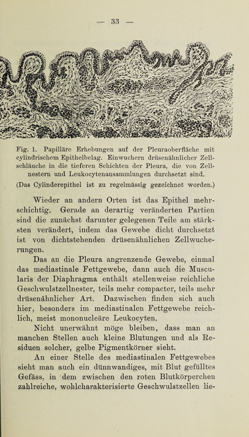 Fig. 1. Papilläre Erhebungen auf der Pleuraoberfläche mit cylindrischem Epithelbelag. Einwuchern drüsenähnlicher Zell¬ schläuche in die tieferen Schichten der Pleura, die von Zell¬ nestern und Leukocytenansammlungen durchsetzt sind. (Das Cylinderepithel ist zu regelmässig gezeichnet worden.) Wieder an andern Orten ist das Epithel mehr¬ schichtig. Gerade an derartig veränderten Partien sind die zunächst darunter gelegenen Teile am stärk¬ sten verändert, indem das Gewebe dicht durchsetzt ist von dichtstehenden drüsenähnlichen Zellwuche¬ rungen. Das an die Pleura angrenzende Gewebe, einmal das mediastinale Fettgewebe, dann auch die Muscu- laris der Diaphragma enthält stellenweise reichliche Geschwulstzellnester, teils mehr compacter, teils mehr drüsenähnlicher Art. Dazwischen finden sich auch hier, besonders im mediastinalen Fettgewebe reich¬ lich, meist mononucleäre Leukocyten. Nicht unerwähnt möge bleiben, dass man an manchen Stellen auch kleine Blutungen und als Re¬ siduen solcher, gelbe Pigmentkörner sieht. An einer Stelle des mediastinalen Fettgewebes sieht man auch ein dünnwandiges, mit Blut gefülltes Gefäss, in dem zwischen den roten Blutkörperchen zahlreiche, wohlcharakterisierte Geschwulstzellen lie-