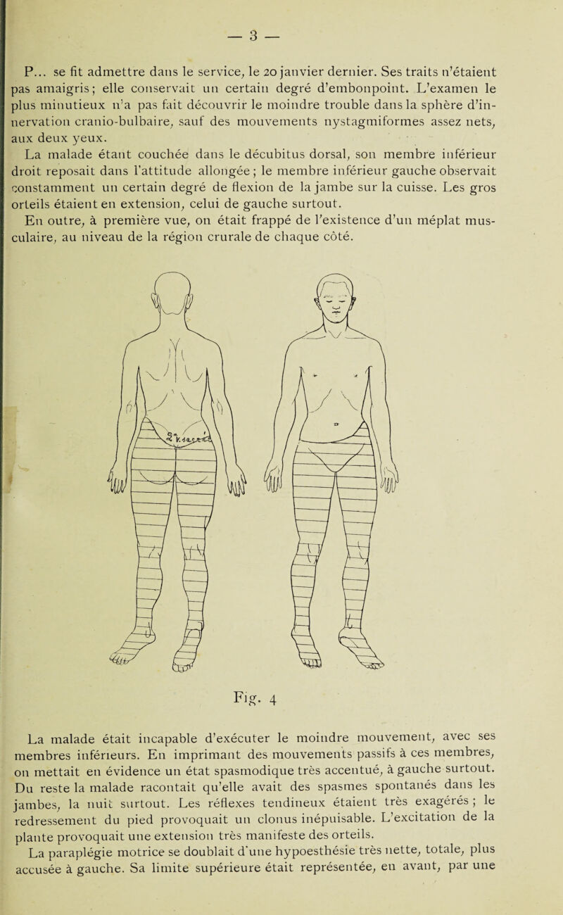 P... se fit admettre dans le service, le 20 janvier dernier. Ses traits n’étaient pas amaigris; elle conservait un certain degré d’embonpoint. L’examen le plus minutieux n’a pas fait découvrir le moindre trouble dans la sphère d’in¬ nervation cranio-bulbaire, sauf des mouvements nystagmiformes assez nets, aux deux yeux. La malade étant couchée dans le décubitus dorsal, son membre inférieur droit reposait dans l’attitude allongée; le membre inférieur gauche observait constamment un certain degré de flexion de la jambe sur la cuisse. Les gros orteils étaient en extension, celui de gauche surtout. En outre, à première vue, on était frappé de l'existence d’un méplat mus¬ culaire, au niveau de la région crurale de chaque côté. La malade était incapable d’exécuter le moindre mouvement, avec ses membres inférieurs. En imprimant des mouvements passifs à ces membres, on mettait en évidence un état spasmodique très accentué, à gauche surtout. Du reste la malade racontait qu’elle avait des spasmes spontanés dans les jambes, la nuit surtout. Les réflexes tendineux étaient très exagérés ; le redressement du pied provoquait un clonus inépuisable. L’excitation de la plante provoquait une extension très manifeste des orteils. La paraplégie motrice se doublait d’une hypoesthésie très nette, totale, plus accusée à gauche. Sa limite supérieure était représentée, en avant, par une