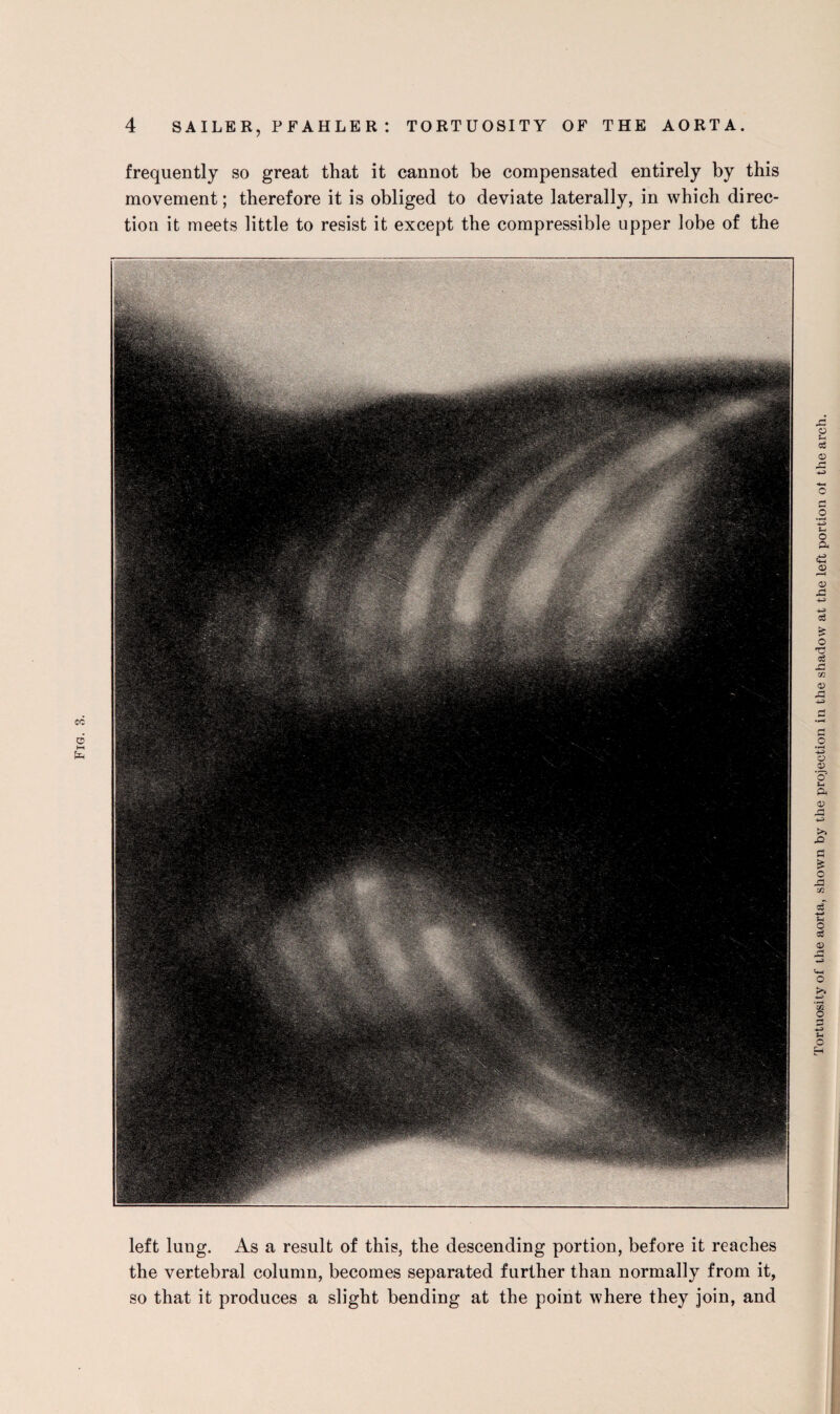 frequently so great that it cannot be compensated entirely by this movement; therefore it is obliged to deviate laterally, in which direc¬ tion it meets little to resist it except the compressible upper lobe of the left lung. As a result of this, the descending portion, before it reaches the vertebral column, becomes separated further than normally from it, so that it produces a slight bending at the point where they join, and