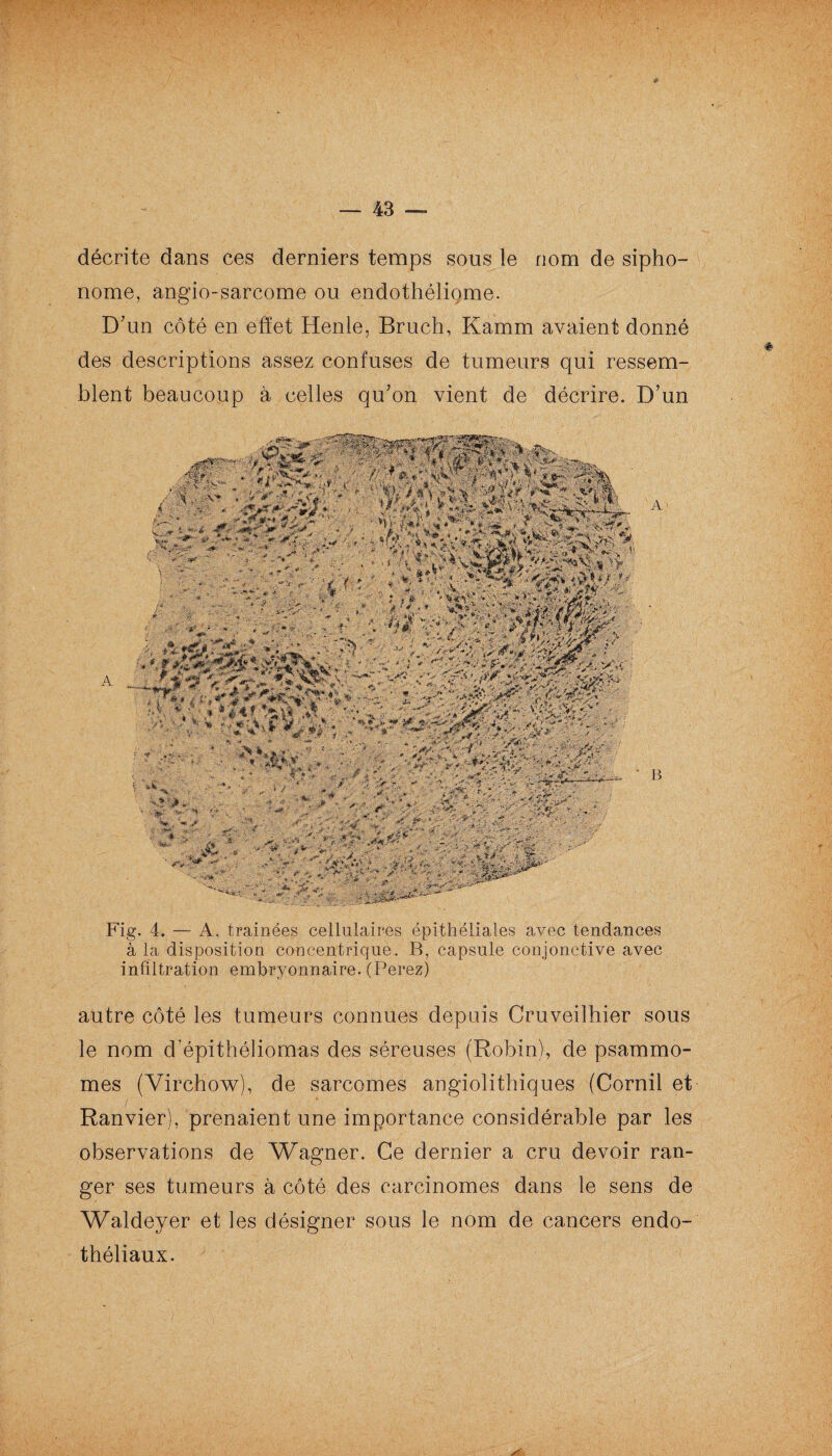 'h F '  ' %\ ■ À , ■'■ ; ; , .. ■m — 43 — décrite dans ces derniers temps sous le nom de sipho- nome, angio-sarcome ou endothéliome. D’un côté en effet Henle, Bruch, Kamm avaient donné des descriptions assez confuses de tumeurs qui ressem¬ blent beaucoup à celles qu’on vient de décrire. D’un A Fig. 4. — A, traînées cellulaires épithéliales avec tendances à la disposition concentrique. B, capsule conjonctive avec infiltration embryonnaire. (Perez) autre côté les tumeurs connues depuis Cruveilhier sous le nom d’épithéliomas des séreuses (Robin), de psammo- mes (Virchow), de sarcomes angiolithiques (Cornil et Ranvier), prenaient une importance considérable par les observations de Wagner. Ce dernier a cru devoir ran¬ ger ses tumeurs à côté des carcinomes dans le sens de Waldeyer et les désigner sous le nom de cancers endo¬ théliaux.