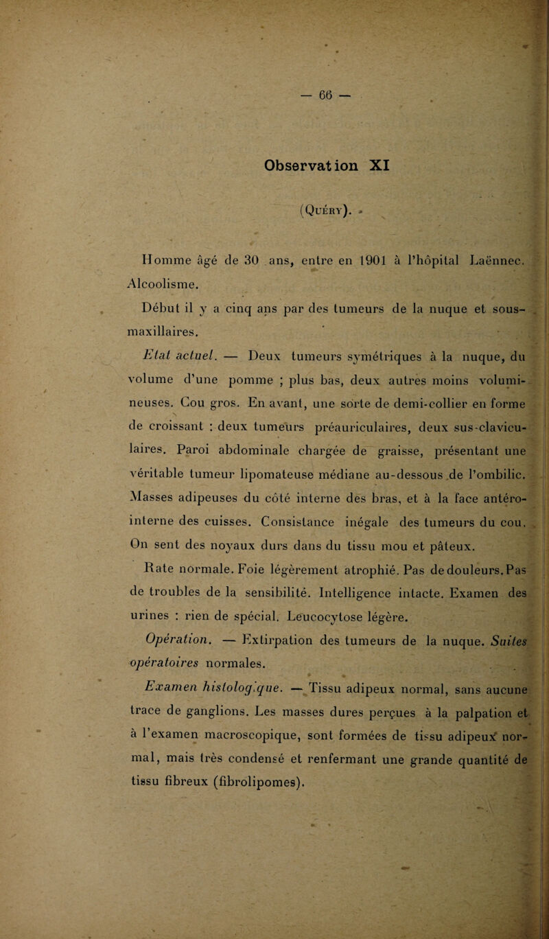 Observation XI (Quéry). » Homme âgé cîe 30 ans, entre en 1901 à l’hôpital Laënnec. Alcoolisme. Début il y a cinq ans par des tumeurs de la nuque et sous- maxillaires. Etat actuel. — Deux tumeurs symétriques à la nuque, du volume d’une pomme ; plus bas, deux autres moins volumi¬ neuses. Cou gros. En avant, une sorte de demi-collier en forme de croissant : deux tumeurs préauriculaires, deux sus-clavicu¬ laires. Paroi abdominale chargée de graisse, présentant une véritable tumeur lipomateuse médiane au-dessous de l’ombilic. Masses adipeuses du côté interne des bras, et à la face antéro- interne des cuisses. Consistance inégale des tumeurs du cou. On sent des noyaux durs dans du tissu mou et pâteux. Rate normale. Foie légèrement atrophié. Pas de douleurs. Pas de troubles de la sensibilité. Intelligence intacte. Examen des urines : rien de spécial. Leucocytose légère. Opération. — Extirpation des tumeurs de la nuque. Suites opératoires normales. e* * Examen histologique. — Tissu adipeux normal, sans aucune trace de ganglions. Les masses dures perçues à la palpation et à 1 examen macroscopique, sont formées de tissu adipeux' nor^- mal, mais très condensé et renfermant une grande quantité de tissu fibreux (fibrolipomes).