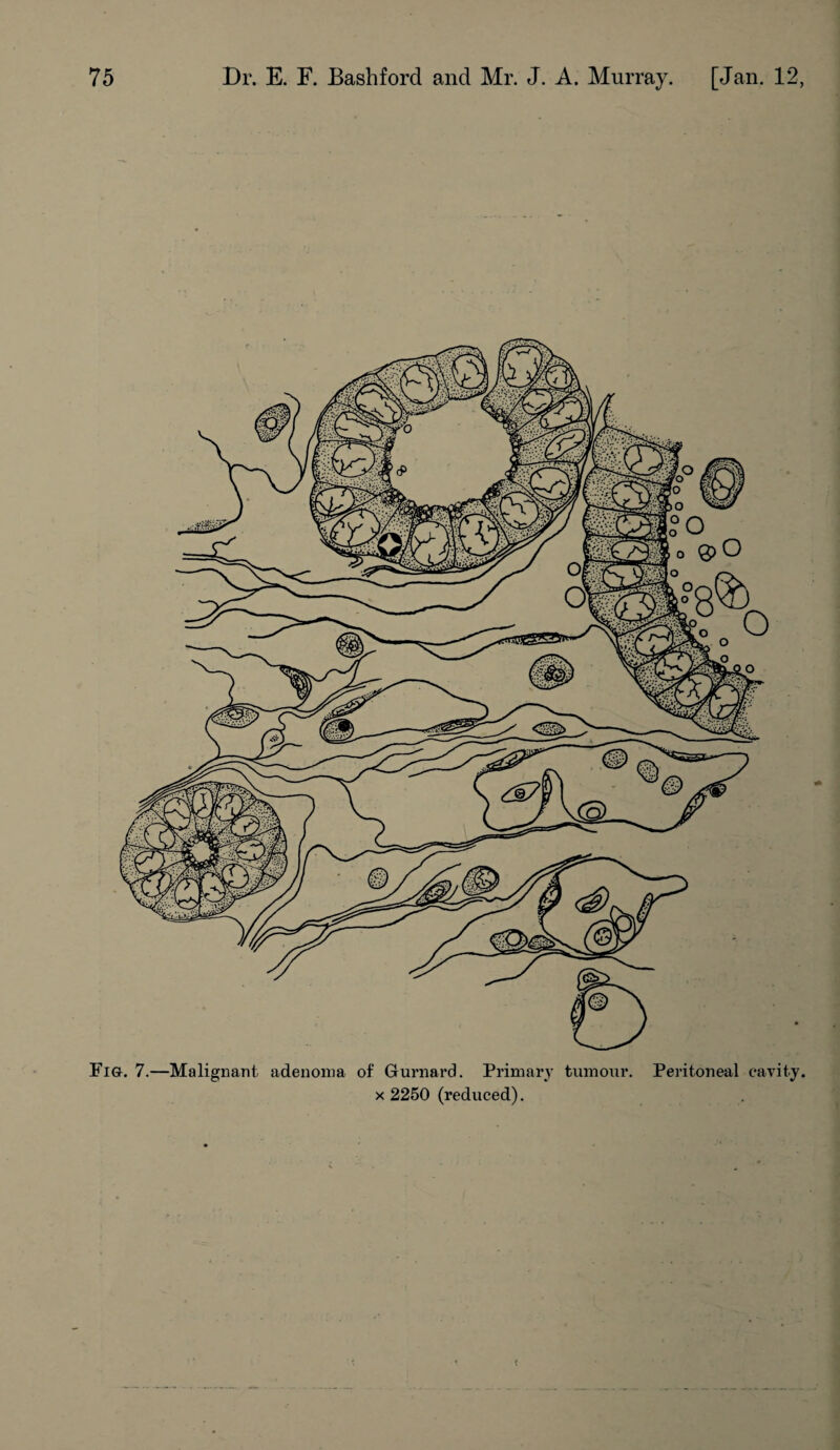 Fig. 7.—Malignant adenoma of Gurnard. Primary tumour. Peritoneal cavity. x 2250 (reduced).