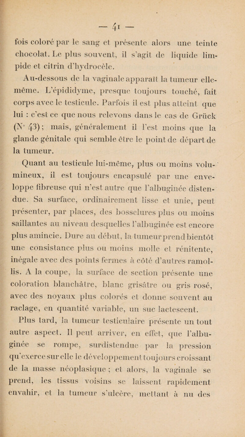 fois coloré par le sang et présente alors une teinte chocolat. Le plus souvent, il s’agit de liquide lim¬ pide et citrin d’hydrocèle. Au-dessous de la vaginale apparaît la tumeur elle- même. L’épididyme, presque toujours touché, fait corps avec le testicule. Parfois il est plus atteint que lui : c'est ce que nous relevons dans le cas de Grück (N° 43) ; mais, généralement il l’est moins que la glande génitale qui semble être le point de départ de la tumeur. Quant au testicule lui-même, plus ou moins volu¬ mineux, il est toujours encapsulé par une enve¬ loppe fibreuse qui n’est autre que l’albuginée disten¬ due. Sa surface, ordinairement lisse et unie, peut présenter, par places, des bosselures plus ou moins saillantes au niveau desquelles l’albuginée est encore plus amincie. Dure au début, la tumeur prend bientôt une consistance plus ou moins molle et rénitente, inégale avec des points fermes à côté d’autres ramol¬ lis. A la coupe, la surface de section présente une coloration blanchâtre, blanc grisâtre ou gris rosé, avec des noyaux plus colorés et donne souvent au raclage, en quantité variable, un suc lactescent. Plus tard, la tumeur testiculaire présente un tout autre aspect. 11 peut arriver, en effet, que l’albu¬ ginée se rompe, surdistendue par la pression qu exerce sur elle le développement toujours croissant de la masse néoplasique ; et alors, la vaginale se prend, les tissus voisins se laissent rapidement envahir, et la tumeur s’ulcère, mettant à nu des