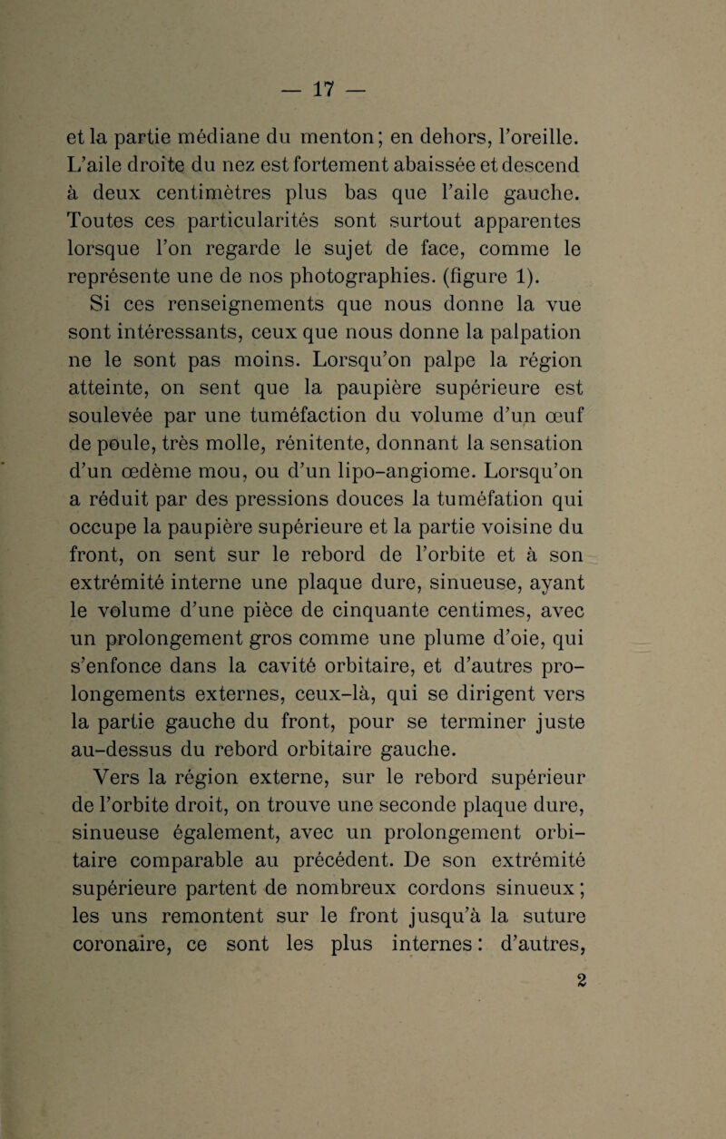 17 — et la partie médiane du menton; en dehors, l’oreille. L’aile droite du nez est fortement abaissée et descend à deux centimètres plus bas que l’aile gauche. Toutes ces particularités sont surtout apparentes lorsque l’on regarde le sujet de face, comme le représente une de nos photographies, (figure 1). Si ces renseignements que nous donne la vue sont intéressants, ceux que nous donne la palpation ne le sont pas moins. Lorsqu’on palpe la région atteinte, on sent que la paupière supérieure est soulevée par une tuméfaction du volume d’un œuf de poule, très molle, rénitente, donnant la sensation d’un œdème mou, ou d’un lipo-angiome. Lorsqu’on a réduit par des pressions douces la tuméfation qui occupe la paupière supérieure et la partie voisine du front, on sent sur le rebord de l’orbite et à son extrémité interne une plaque dure, sinueuse, ayant le volume d’une pièce de cinquante centimes, avec un prolongement gros comme une plume d’oie, qui s’enfonce dans la cavité orbitaire, et d’autres pro¬ longements externes, ceux-là, qui se dirigent vers la partie gauche du front, pour se terminer juste au-dessus du rebord orbitaire gauche. Vers la région externe, sur le rebord supérieur de l’orbite droit, on trouve une seconde plaque dure, sinueuse également, avec un prolongement orbi¬ taire comparable au précédent. De son extrémité supérieure partent de nombreux cordons sinueux ; les uns remontent sur le front jusqu’à la suture coronaire, ce sont les plus internes : d’autres, 2