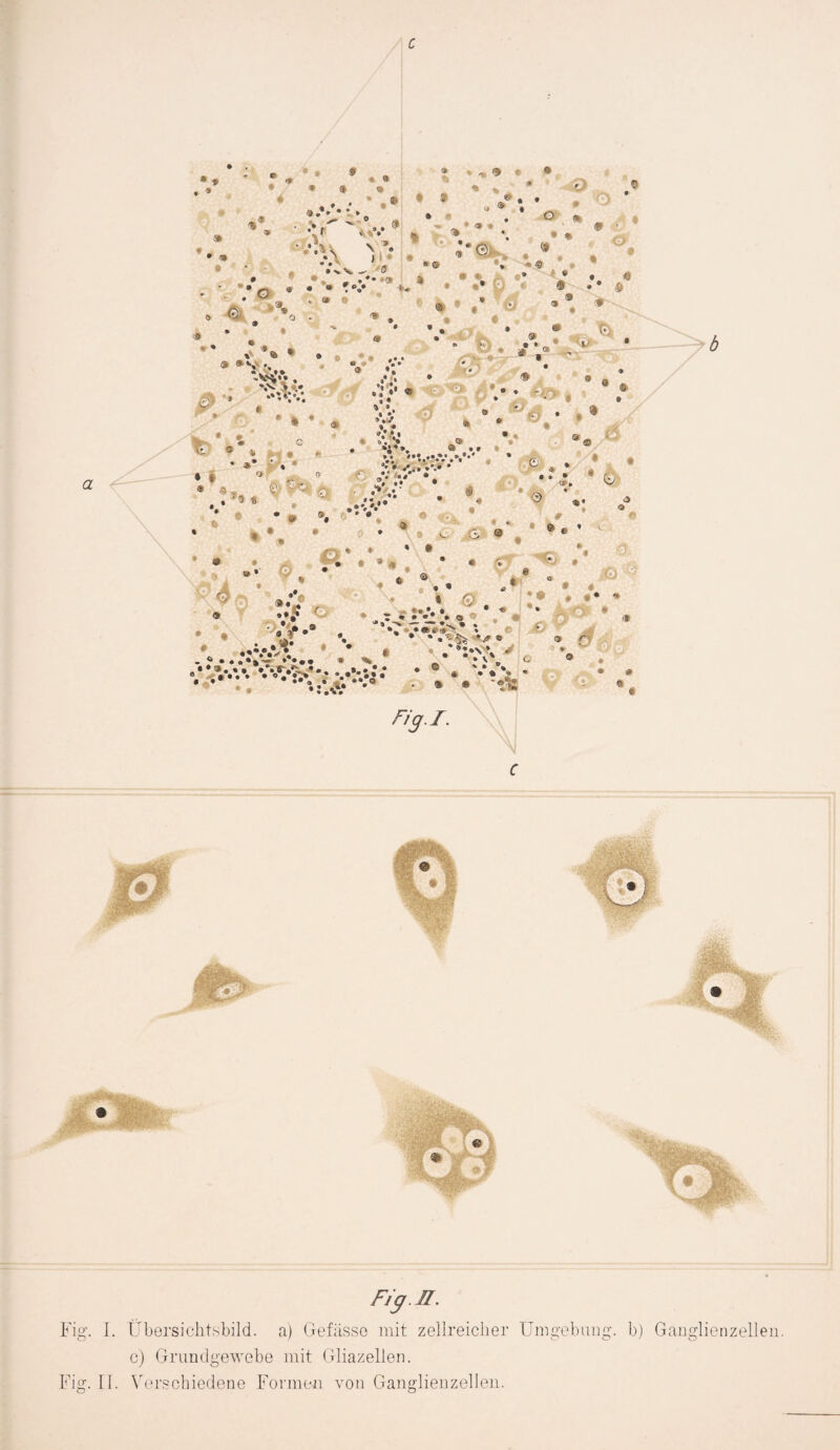 c F/g.H. Fig. I. Übersichtsbild, a) Gefässo mit zellreicher Umgebung, b) Ganglienzellen. c) Grundgewebe mit Gliazellen. Fig. II. Verschiedene Formen von Ganglienzellen.